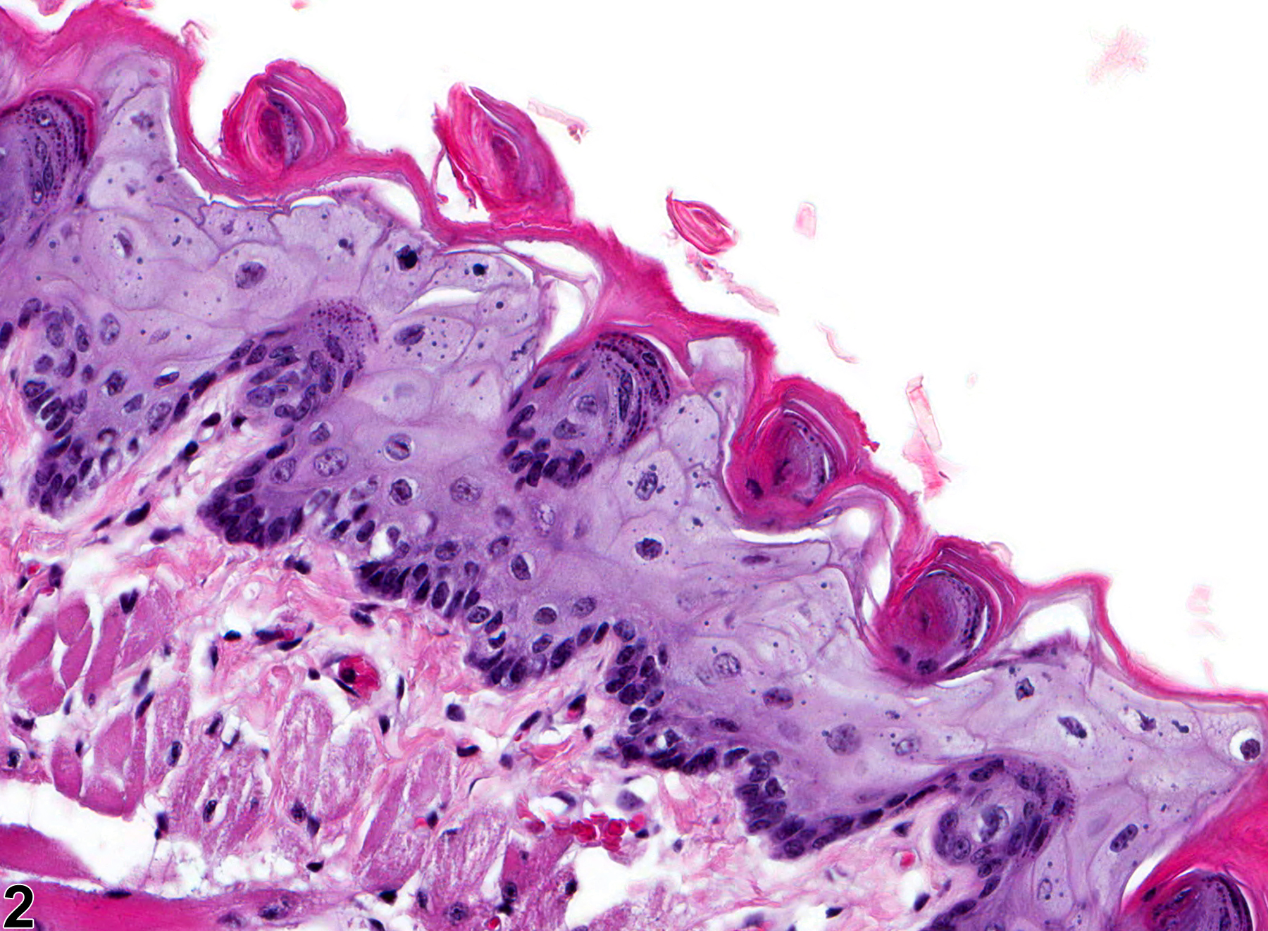 Image of degeneration in the tongue epithelium from a male F344/N rat in a chronic study