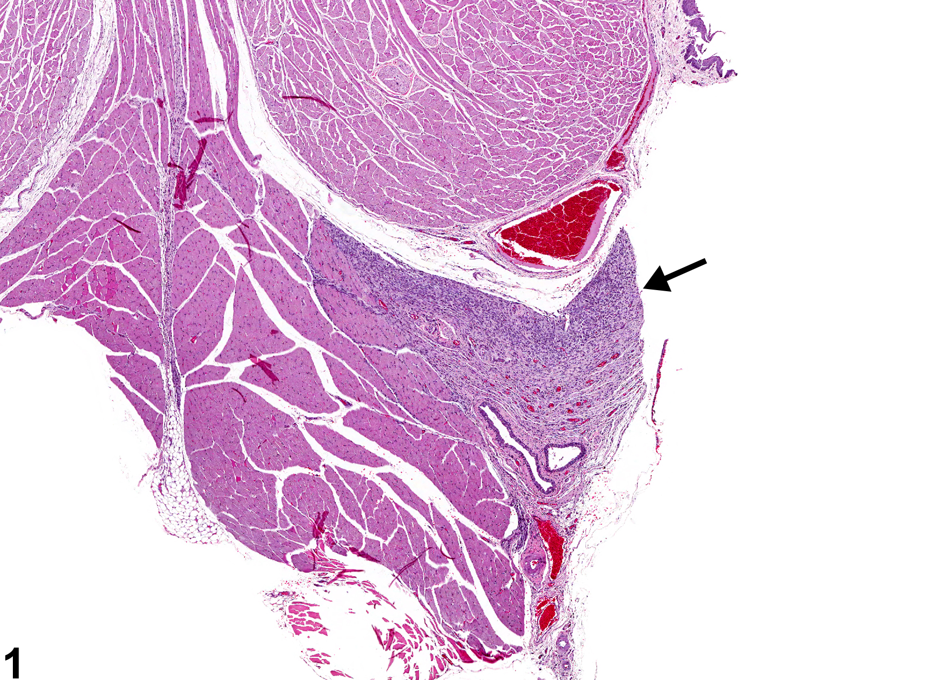 Image of fibrosis in the tongue from a male F344/N rat in a subchronic study