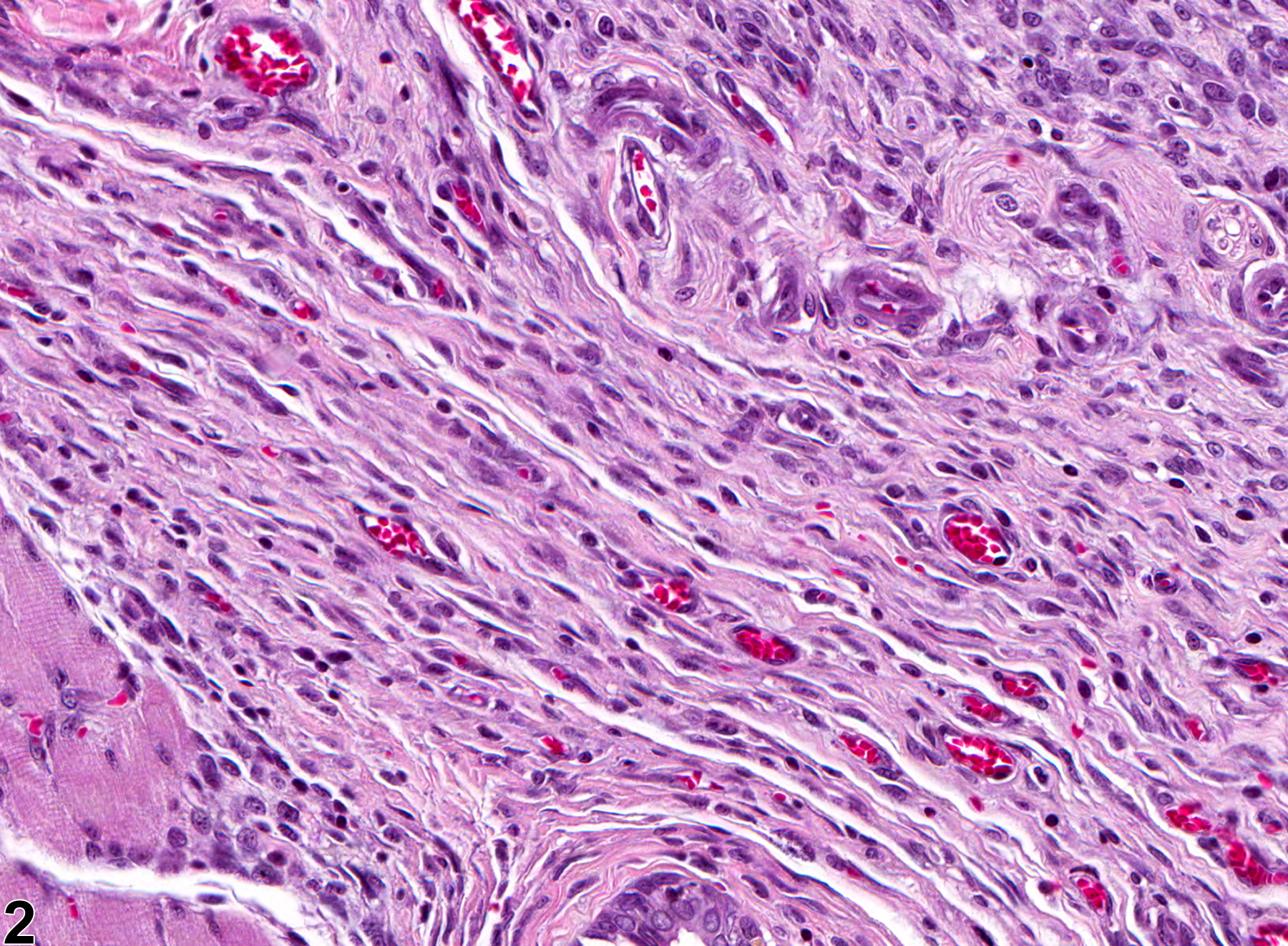Image of fibrosis in the tongue from a male F344/N rat in a subchronic study