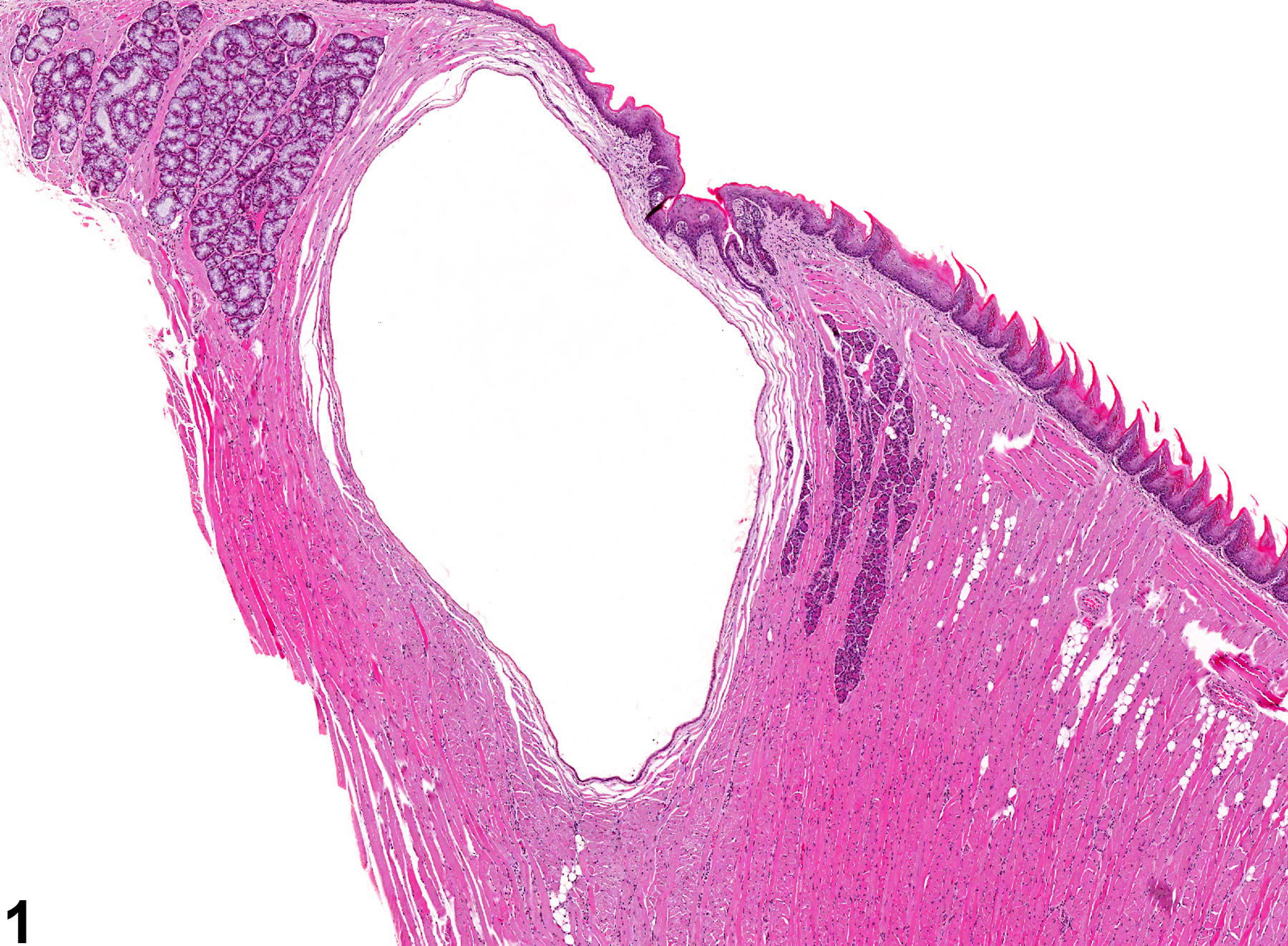 Image of cyst in the tongue glands from a female B6C3F1 mouse in a chronic study
