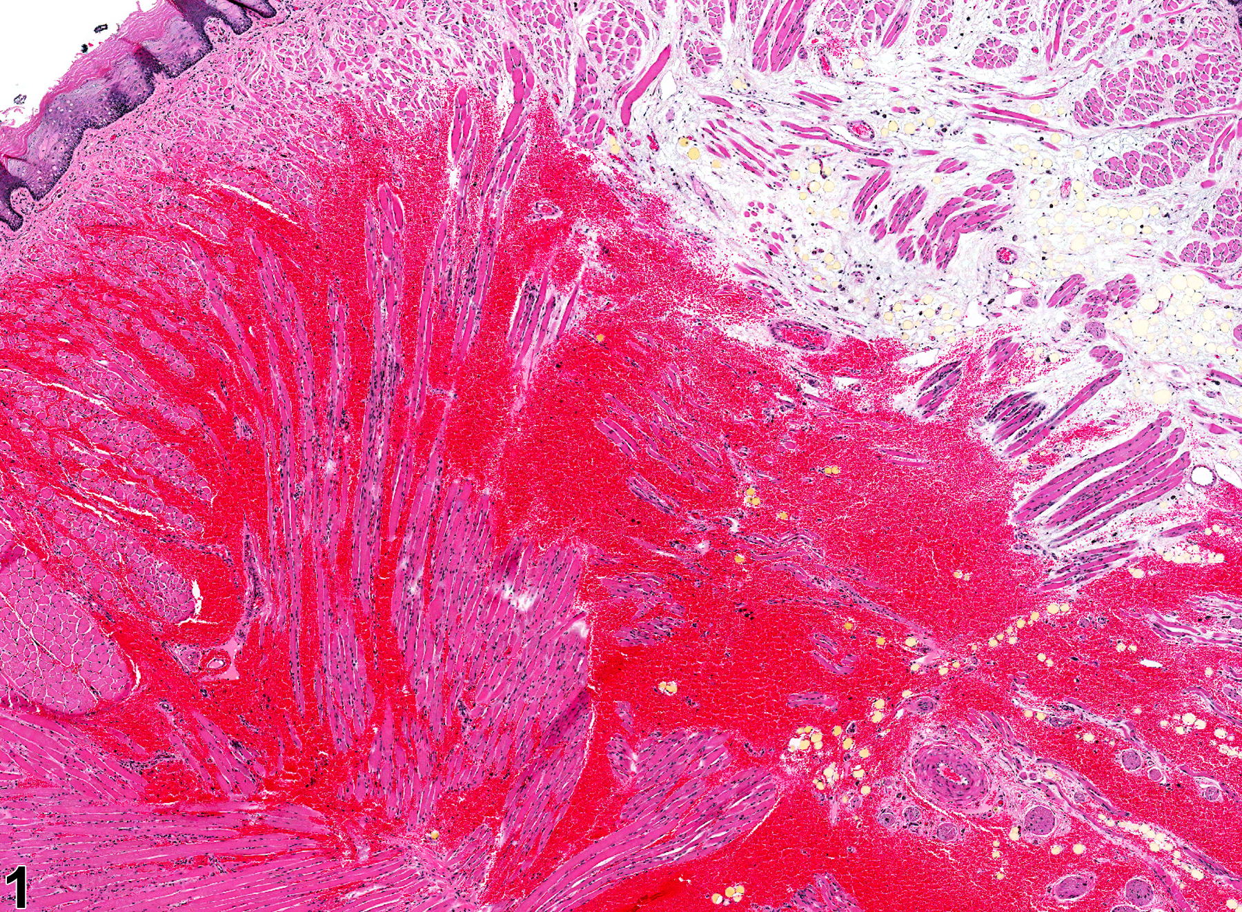 Image of hemorrhage in the tongue from a female HSD rat in a chronic study