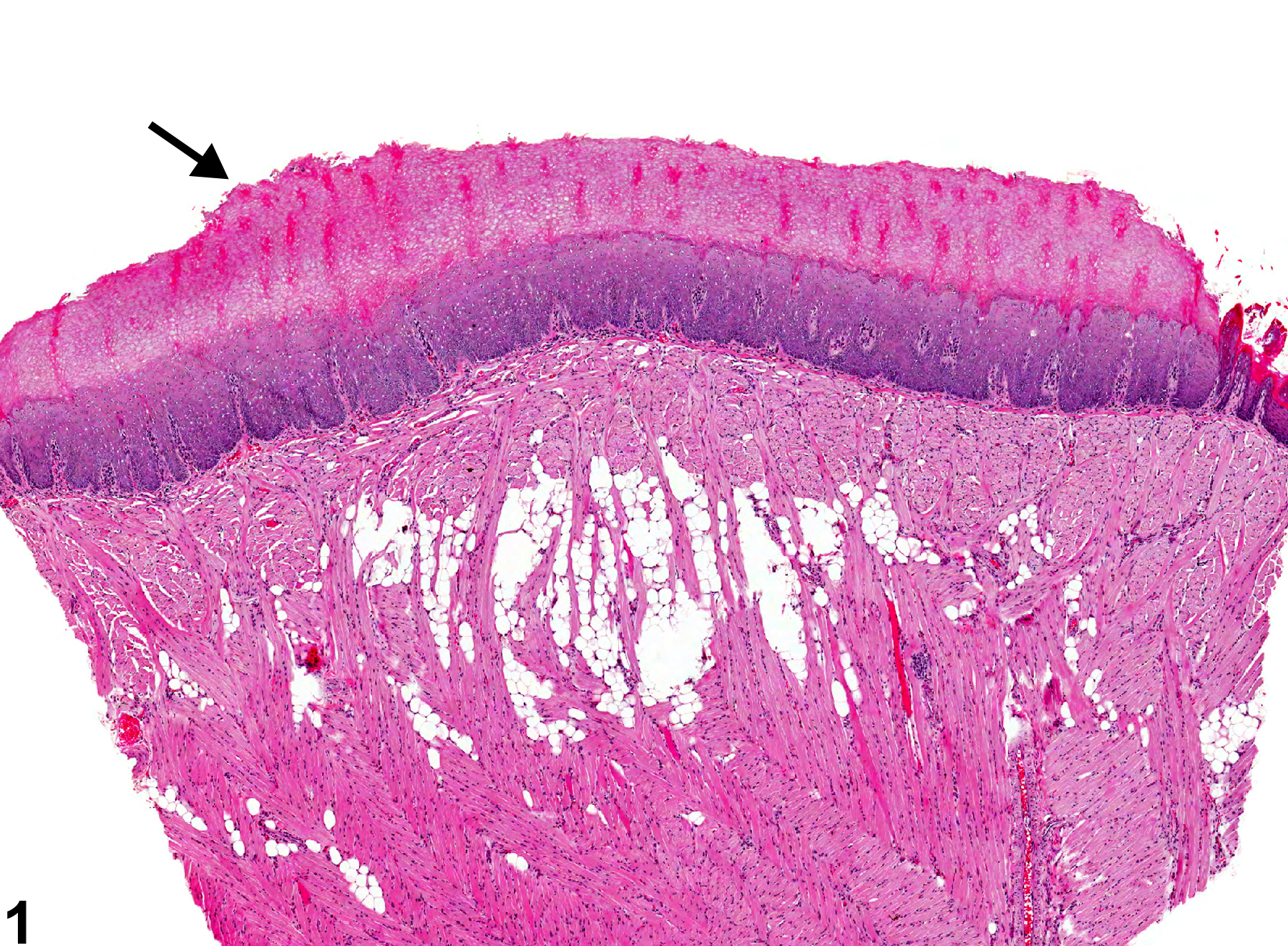Image of hyperkeratosis in the tongue from a female F344/N rat in a chronic study