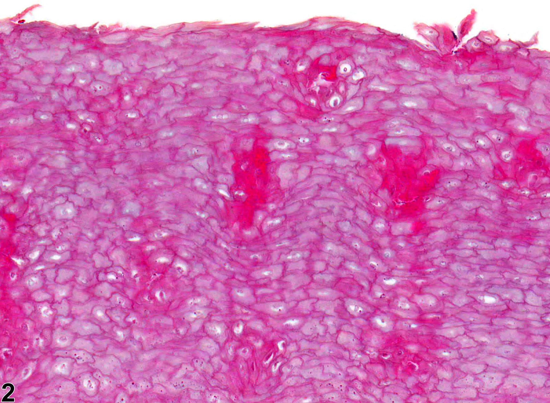 Image of hyperkeratosis in the tongue from a female F344/N rat in a chronic study
