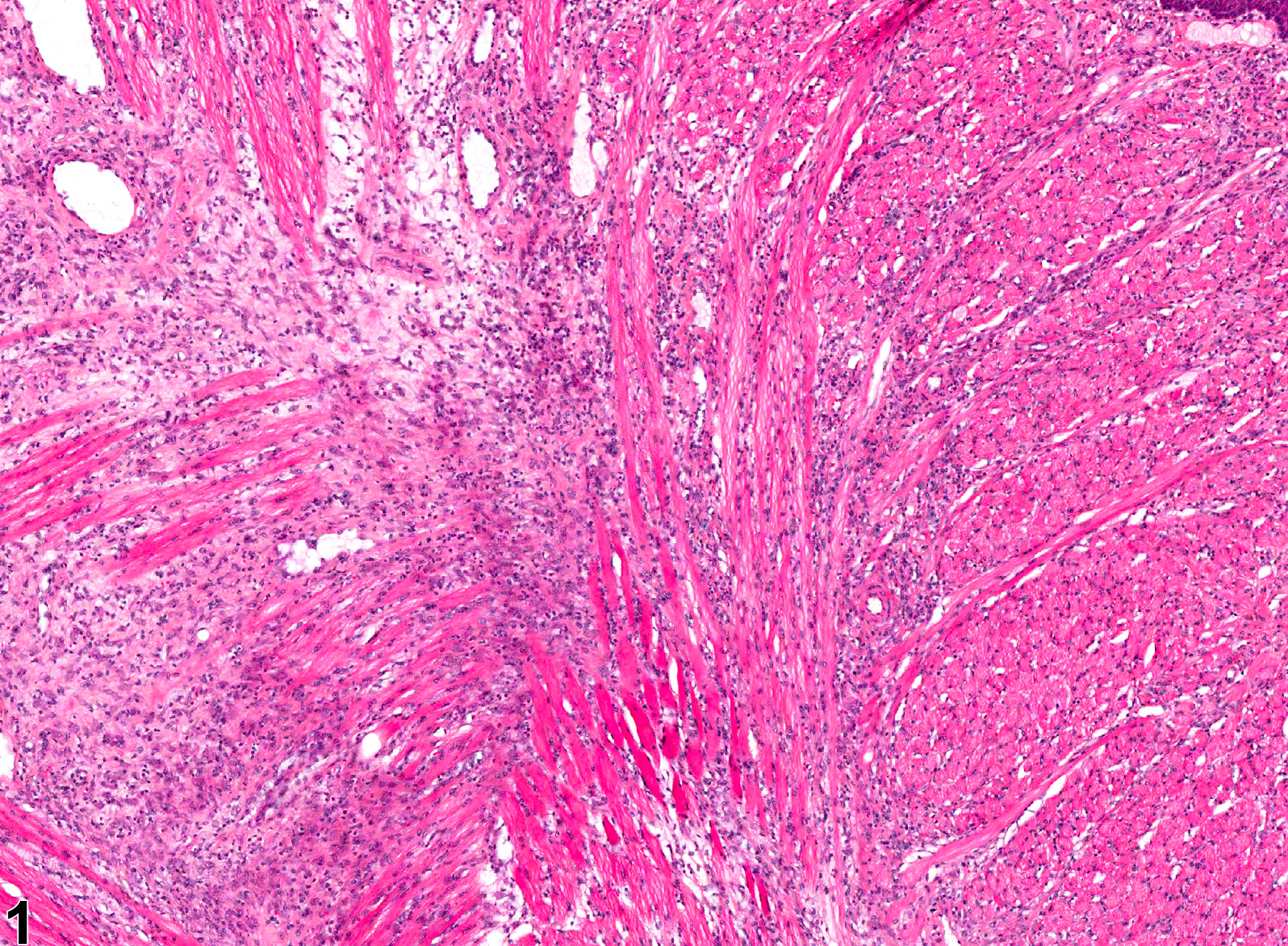 Image of inflammation in the tongue from a female F344/N rat in a chronic study