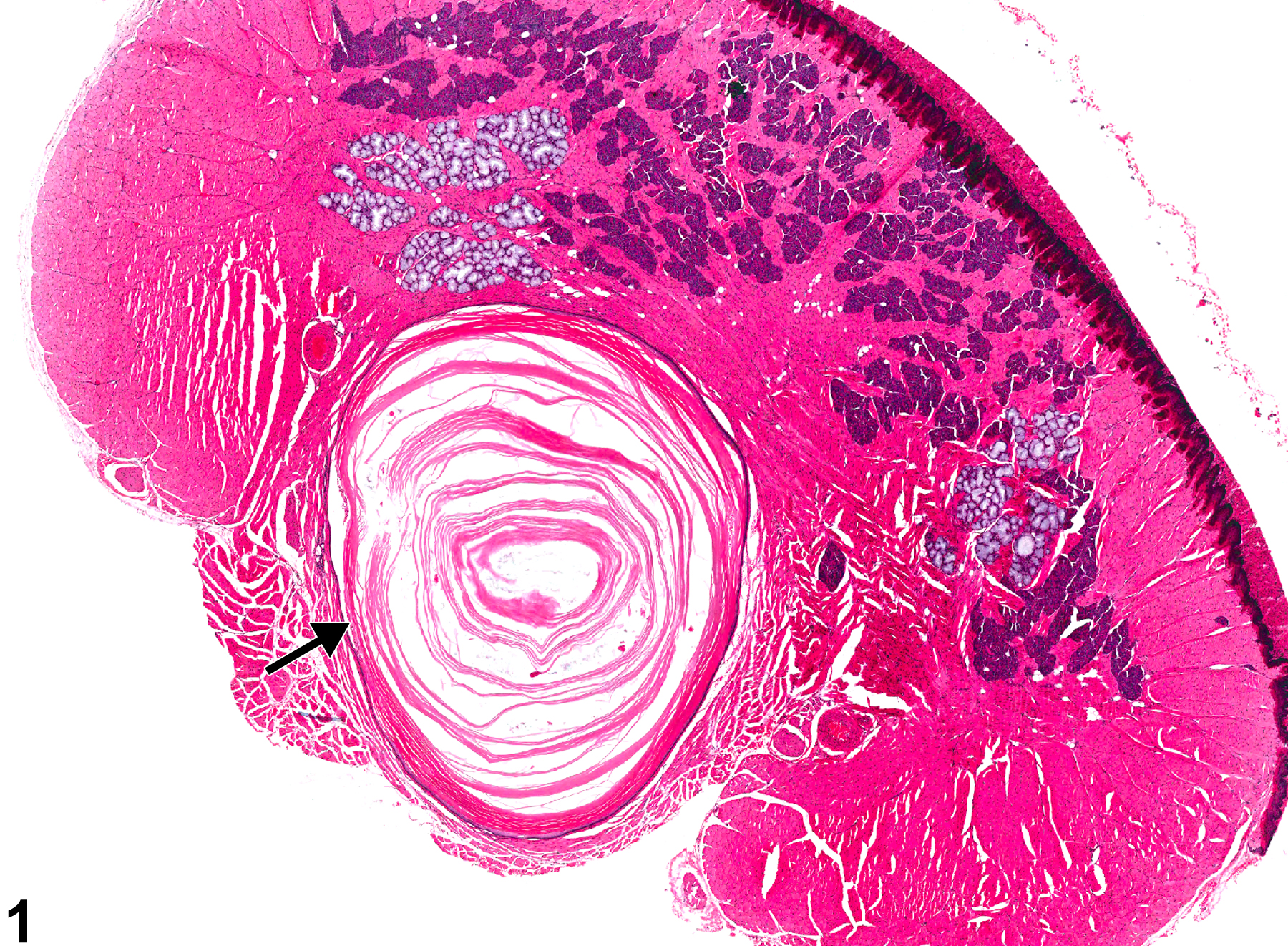 Image of squamous cyst in the tongue from a male F344/N rat in a subchronic study