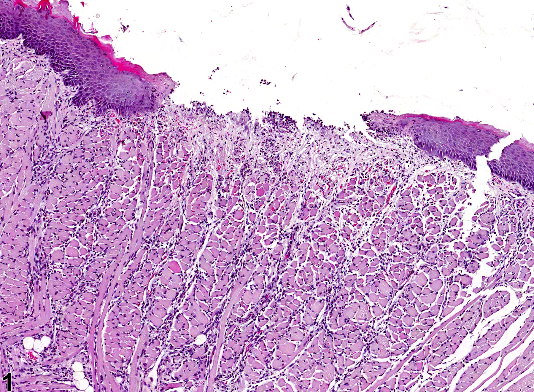 Image of ulcer in the tongue from a female F344/N rat in a chronic study