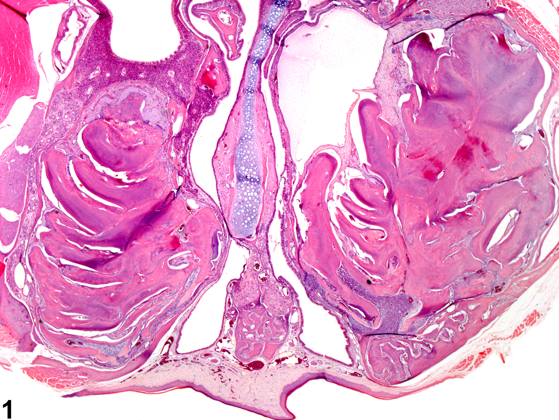 Image of dental dysplasia in the tooth from a male B6C3F1 mouse in a subchronic study