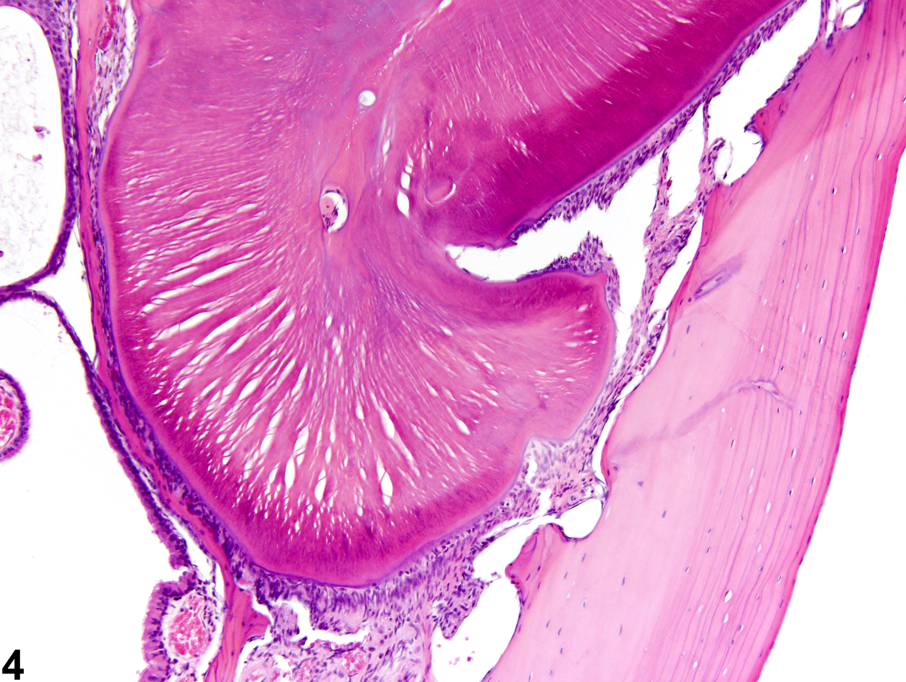 Image of dental dysplasia in the tooth from a male B6C3F1 mouse in a subchronic study