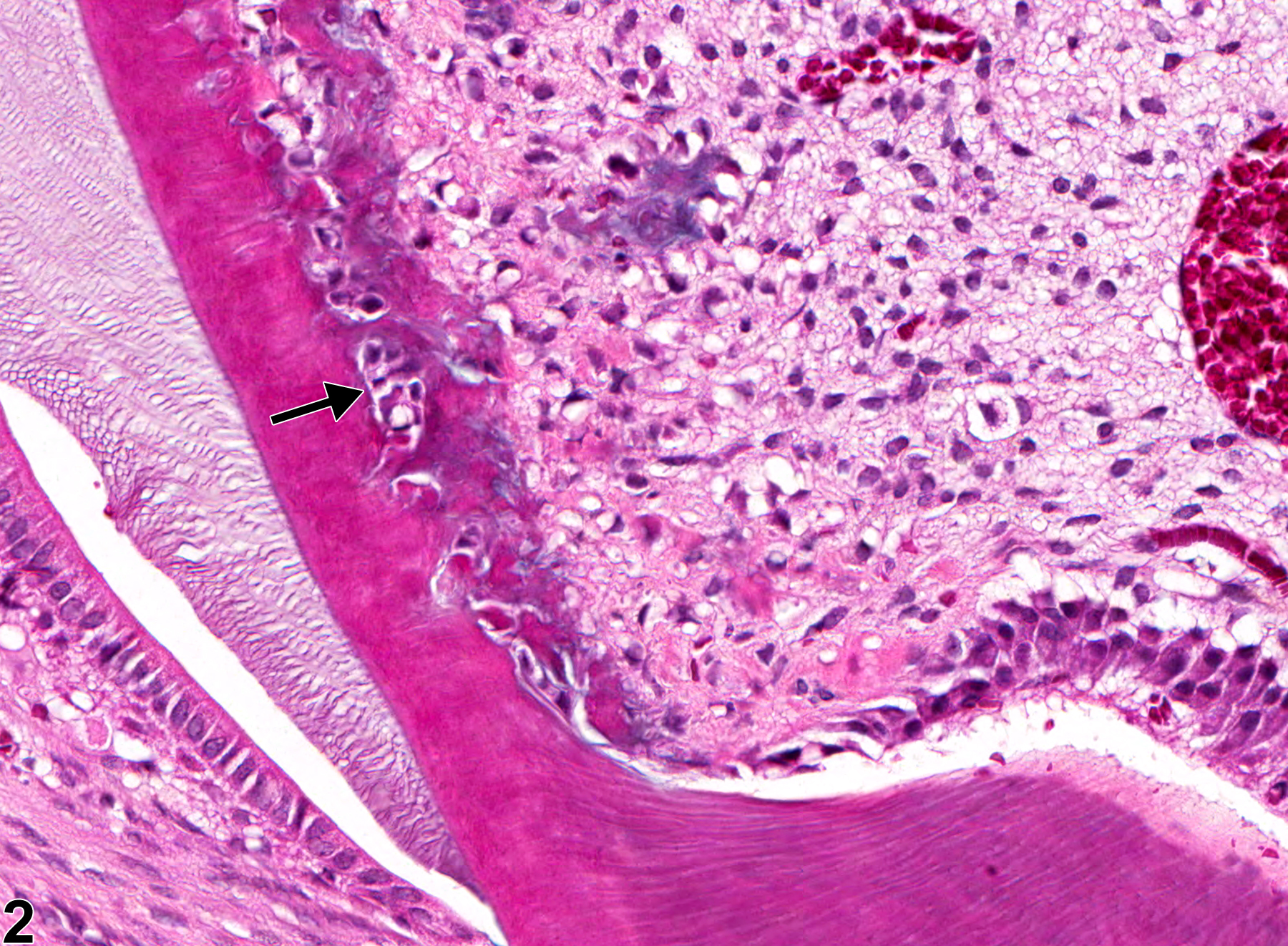 Image of degeneration in the tooth from a female HSD rat in a subchronic study