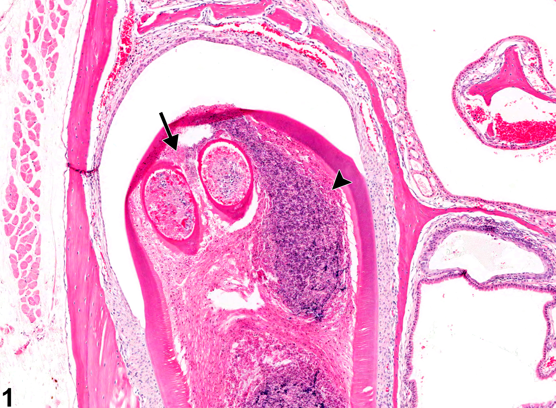 Image of necrosis in the tooth from a male B6C3F1 mouse in a chronic study