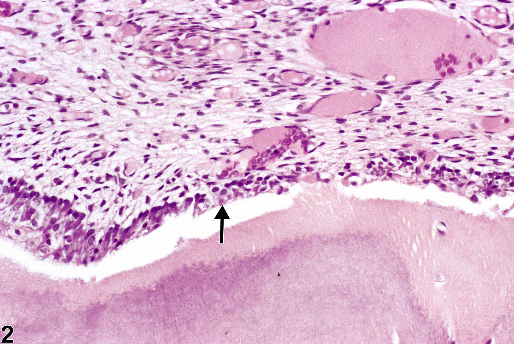 Image of degeneration in the tooth from a male F344/N rat in a chronic study