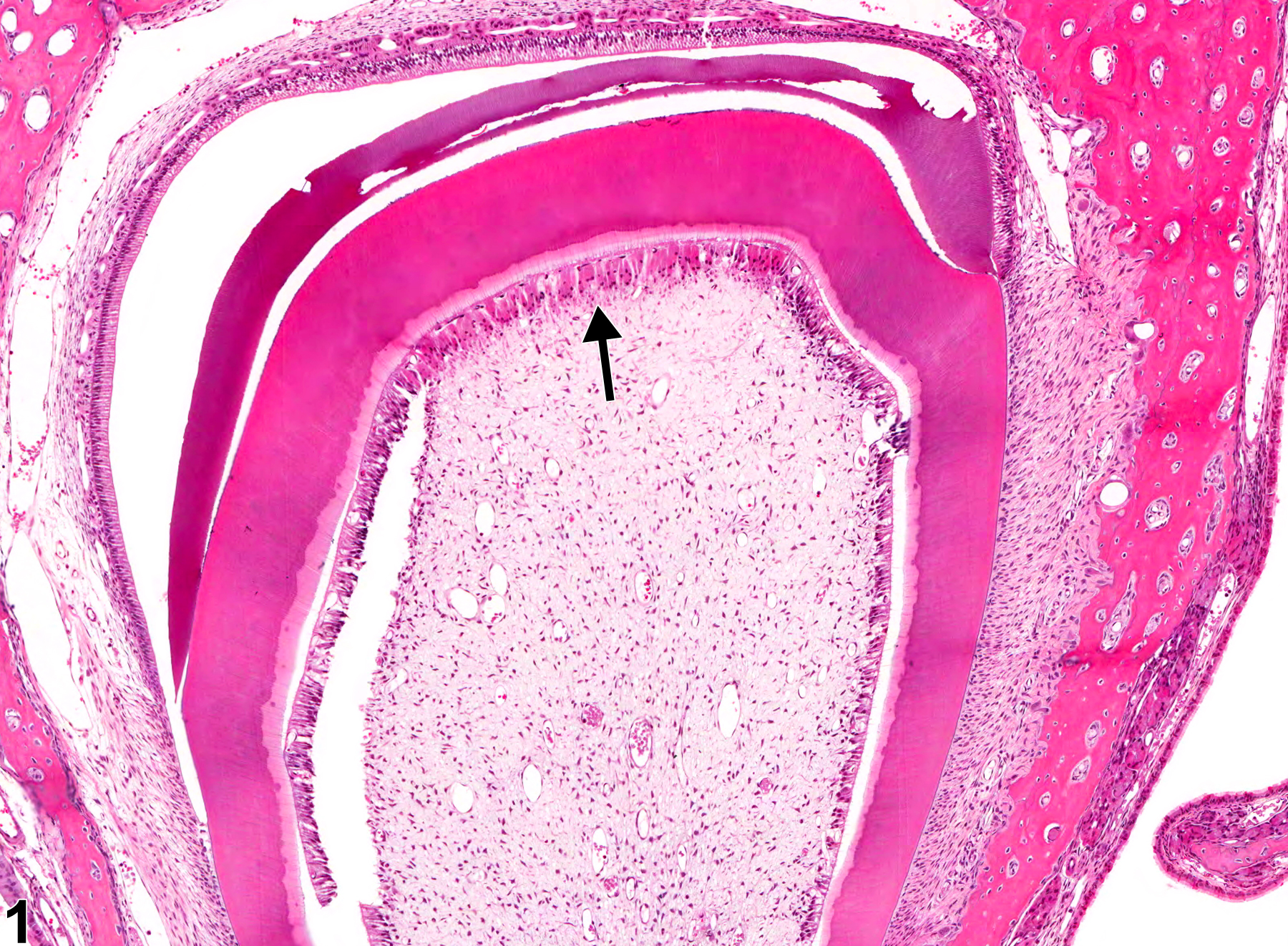 Image of necrosis in the tooth from a female F344/N rat in a subchronic study