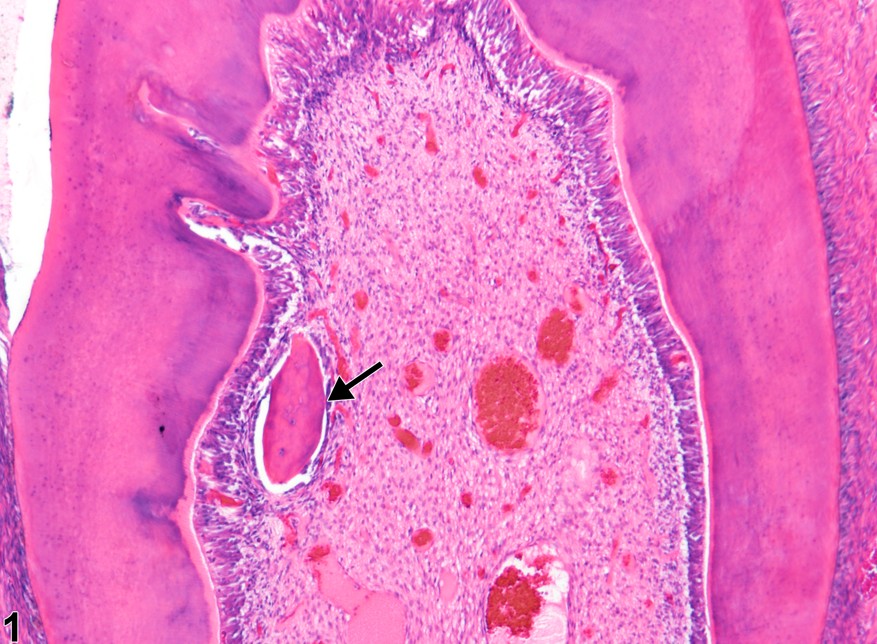 Image of osteodentin in the tooth pulp from a male F344/N rat in a chronic study