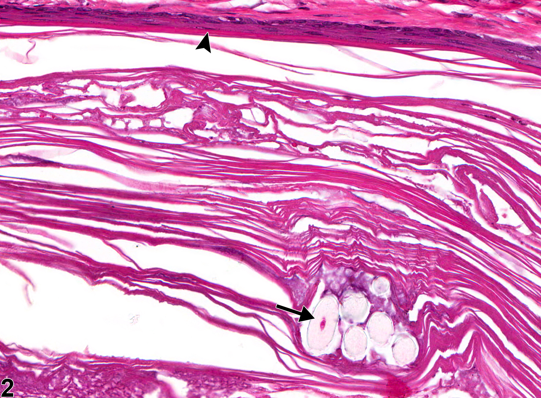 Image of periodontal pocket in the tooth from a male F344/N rat in a chronic study