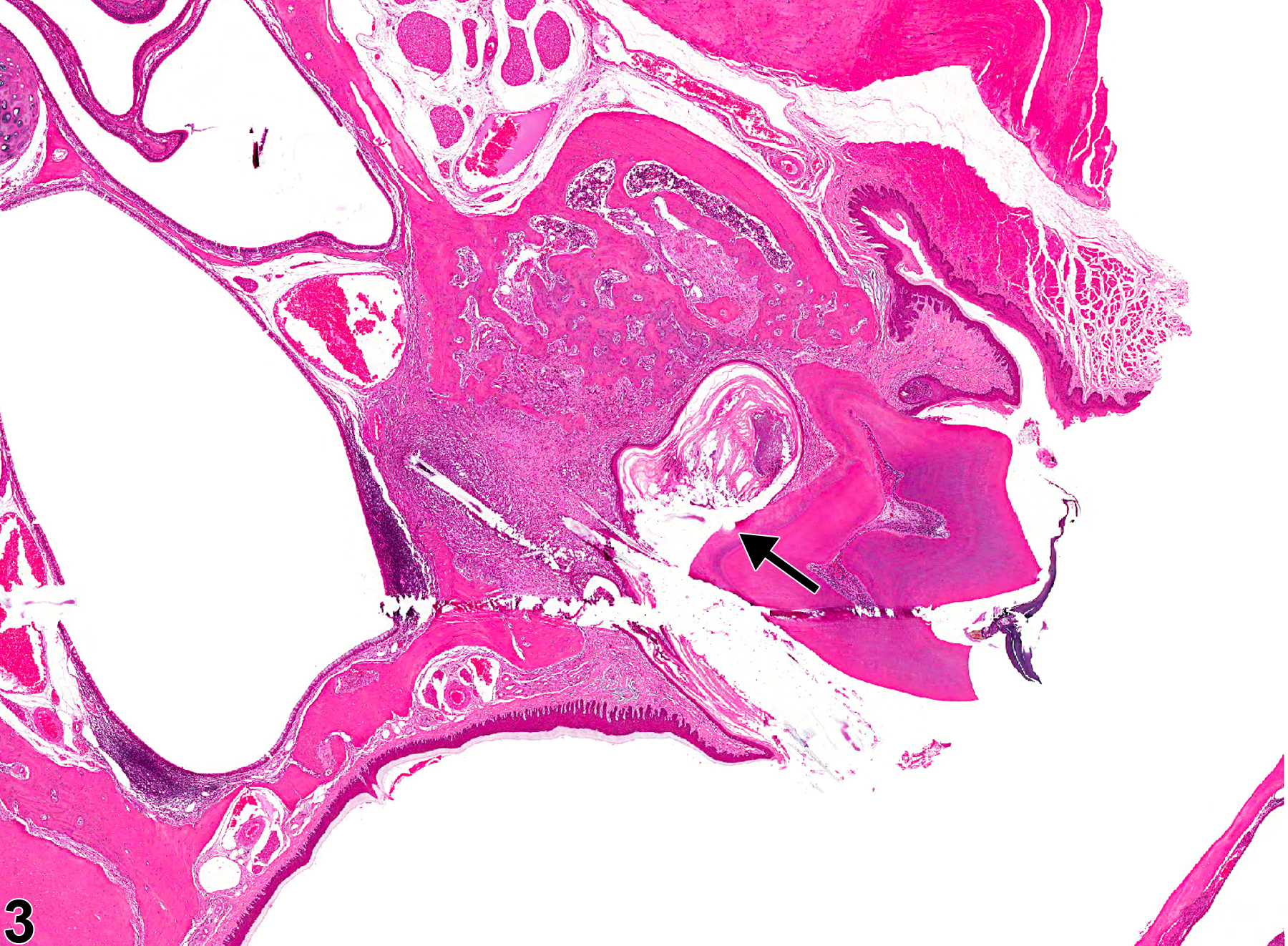 Image of periodontal pocket in the tooth from a male F344/N rat in a chronic study