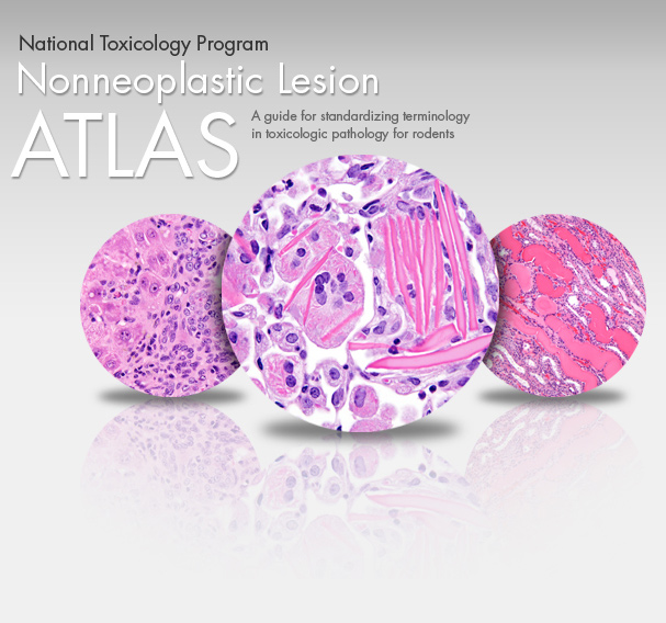 National Toxicology Program Nonneoplastic Lesion Atlas: A guide for standardizing terminology in toxicologic pathology for rodents