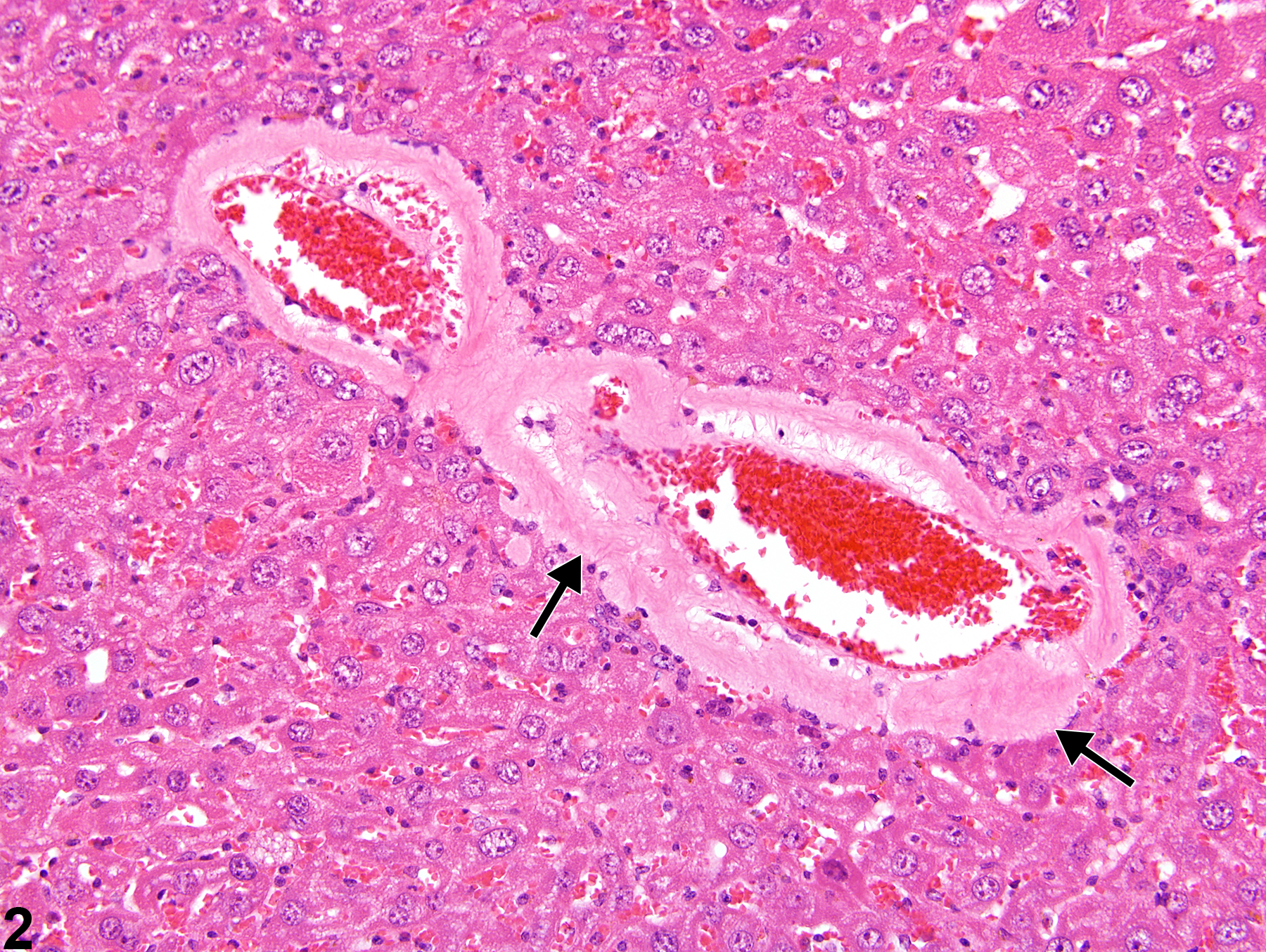 Image of amyloid in the liver, artery from a male Swiss Webster mouse in a chronic study