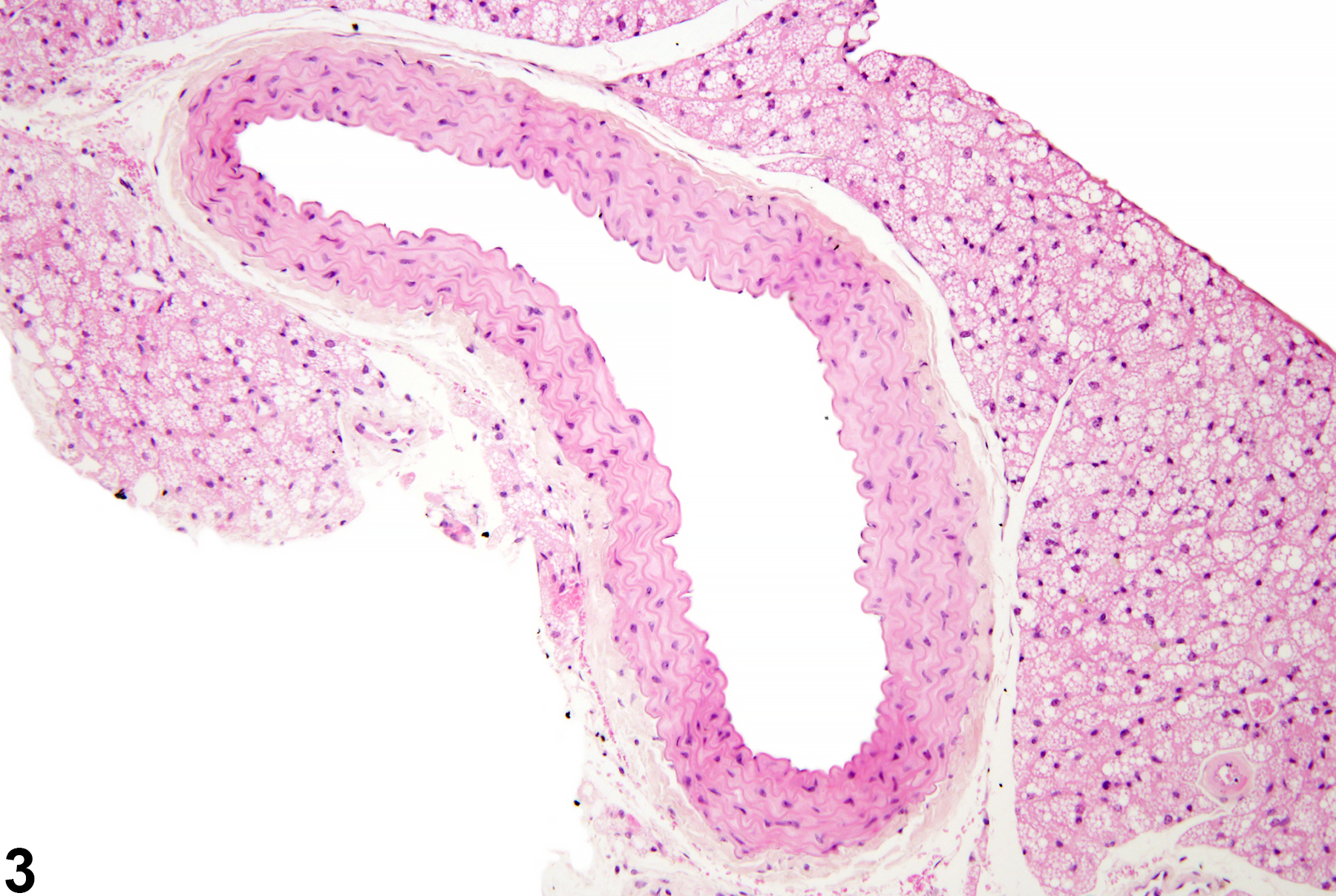 Image of normal in the blood vessel from a male B6C3F1/N mouse in a chronic study