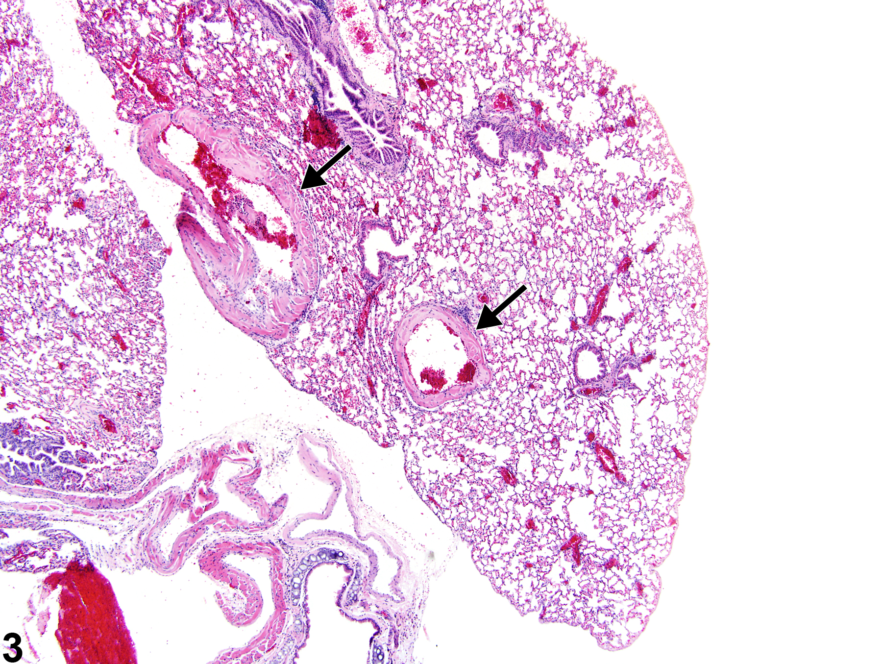 Image of amyloid in the lung, artery from a male Swiss Webster mouse in a chronic study