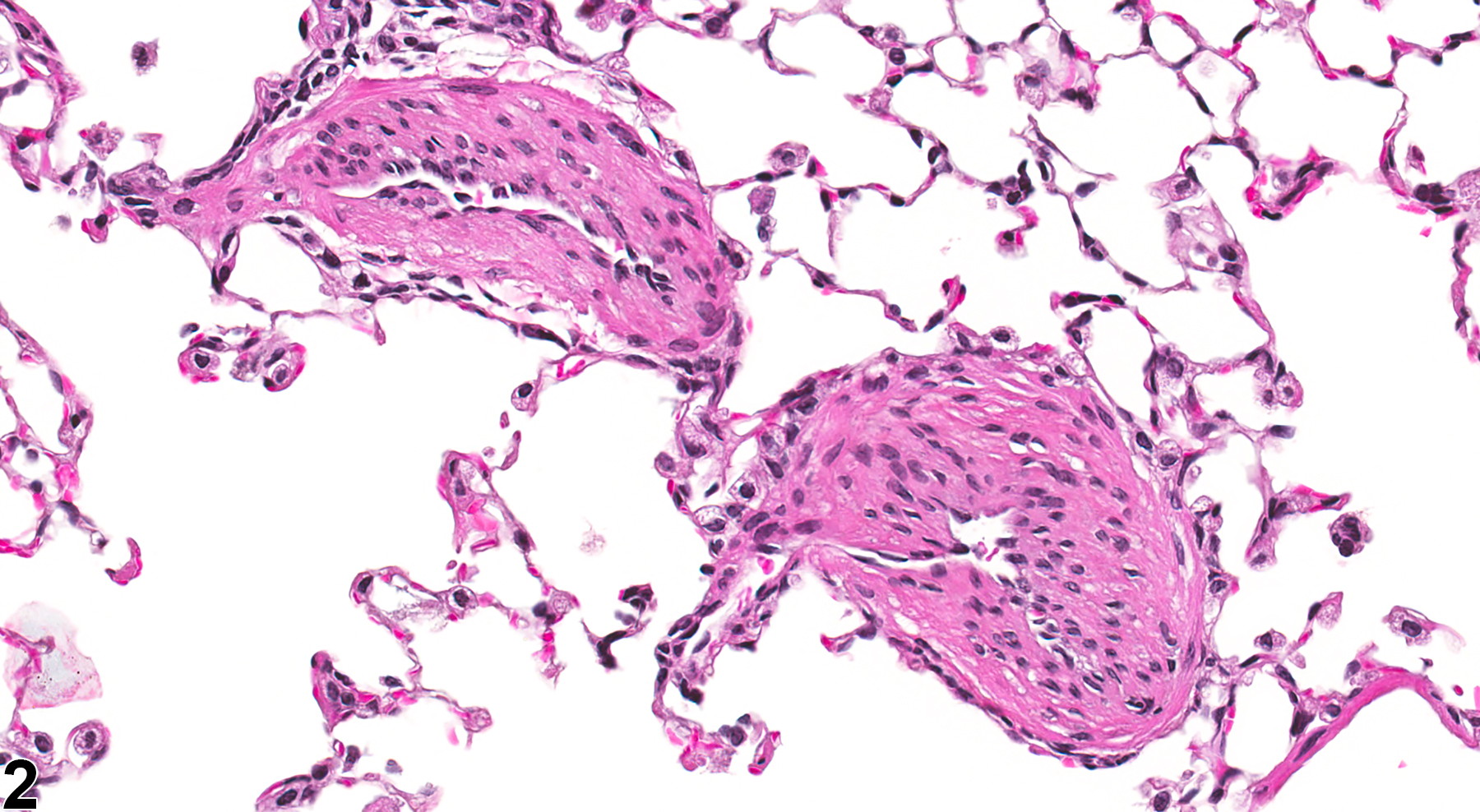 Image of hypertrophy, medial in the lung, artery from a male B6C3F1/N mouse in a subchronic study