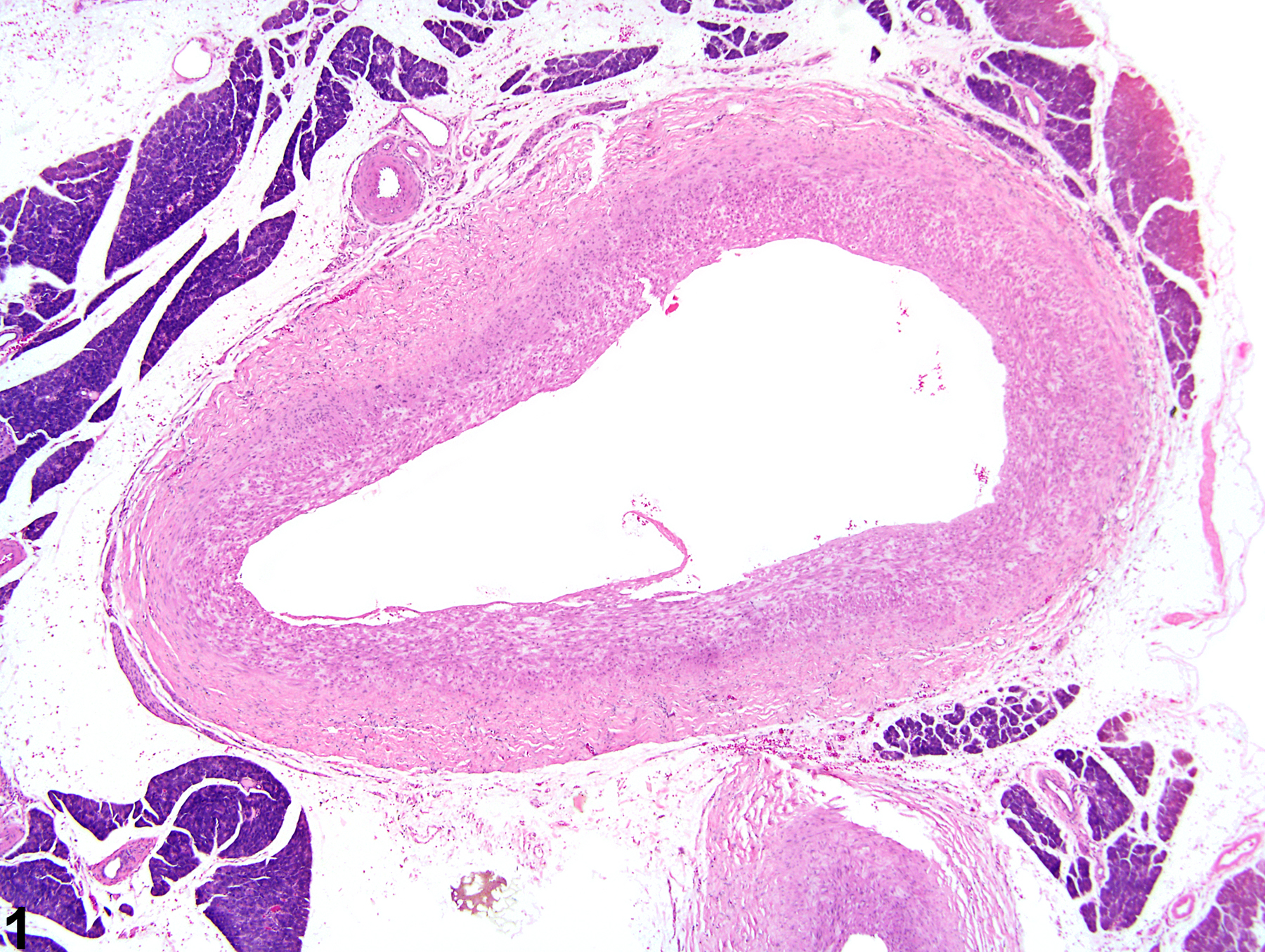 Image of arteriosclerosis in the mesentery, artery from a male F344/N rat in a chronic study