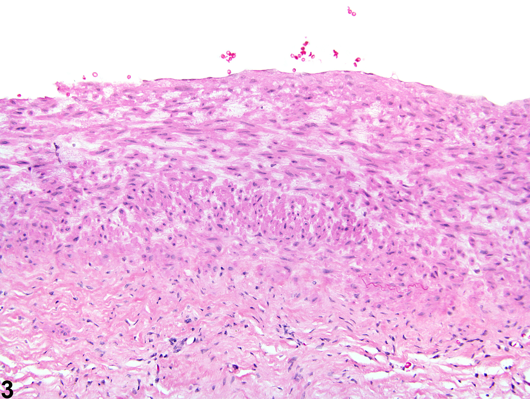Image of arteriosclerosis in the mesentery, artery from a male F344/N rat in a chronic study