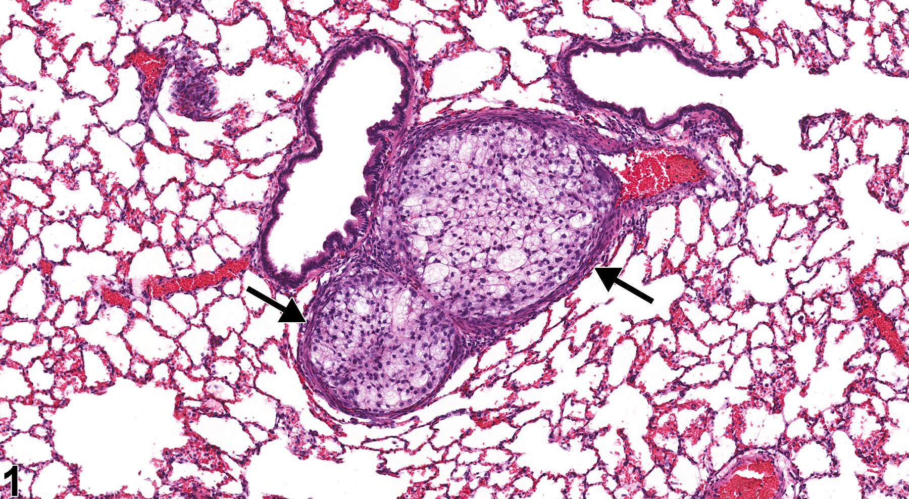 Image of embolus in the lung, artery from a male F344/N rat in a chronic study