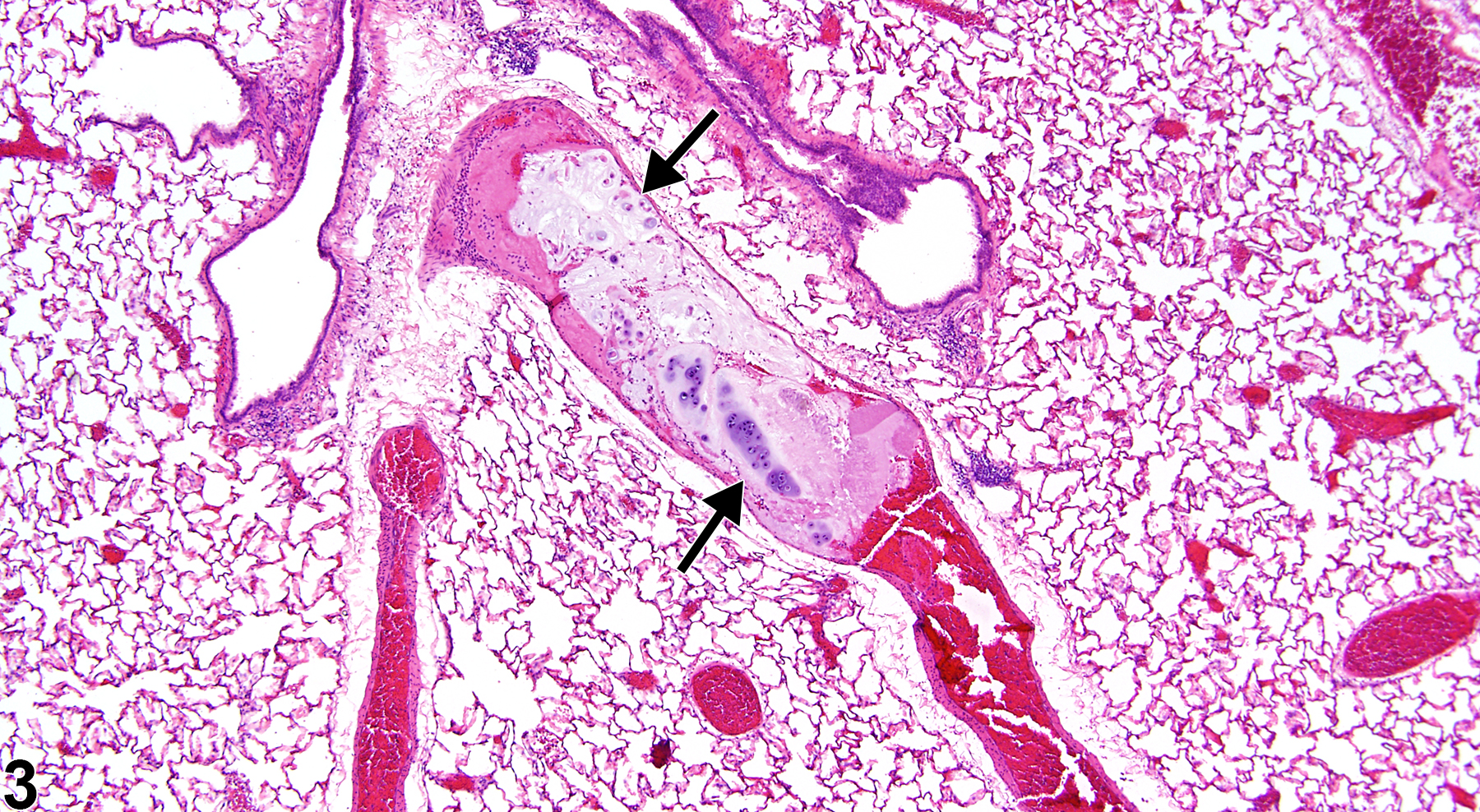 Image of embolus, cartilage in the lung, artery from a male F344/N rat in a chronic study