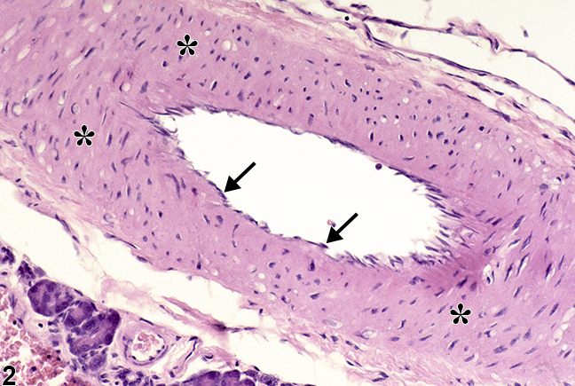 Image of normal blood vessel from a male F344/N rat in a chronic study