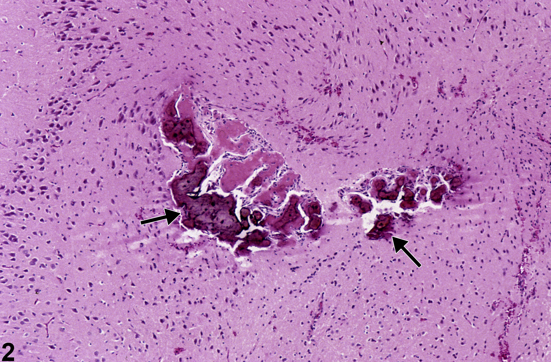 Image of metaplasia, osseous in the brain, artery from a male F344/N rat in a chronic study