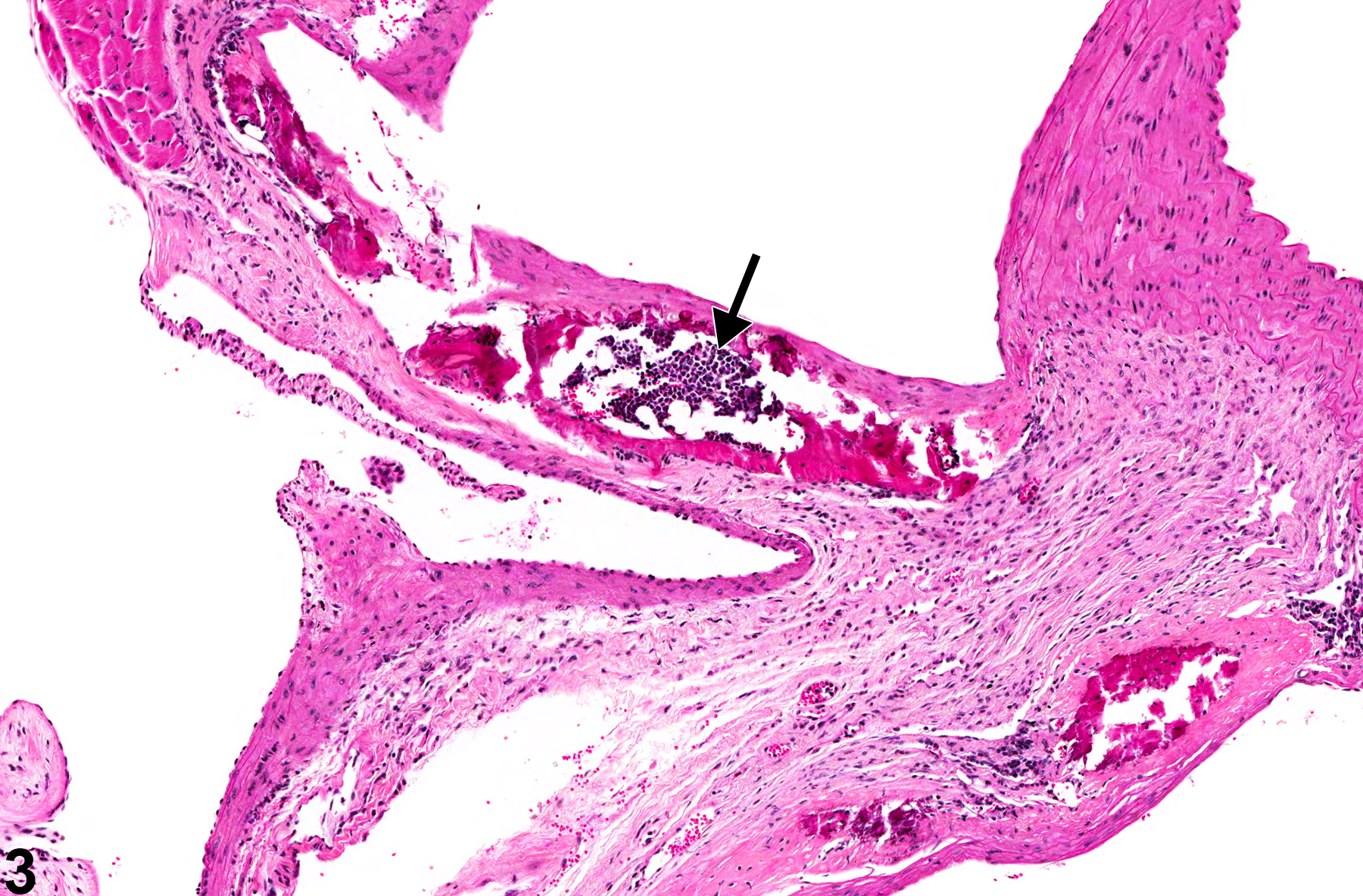 Image of metaplasia, osseous in the aorta from a female B6C3F1/N mouse in a subchronic study