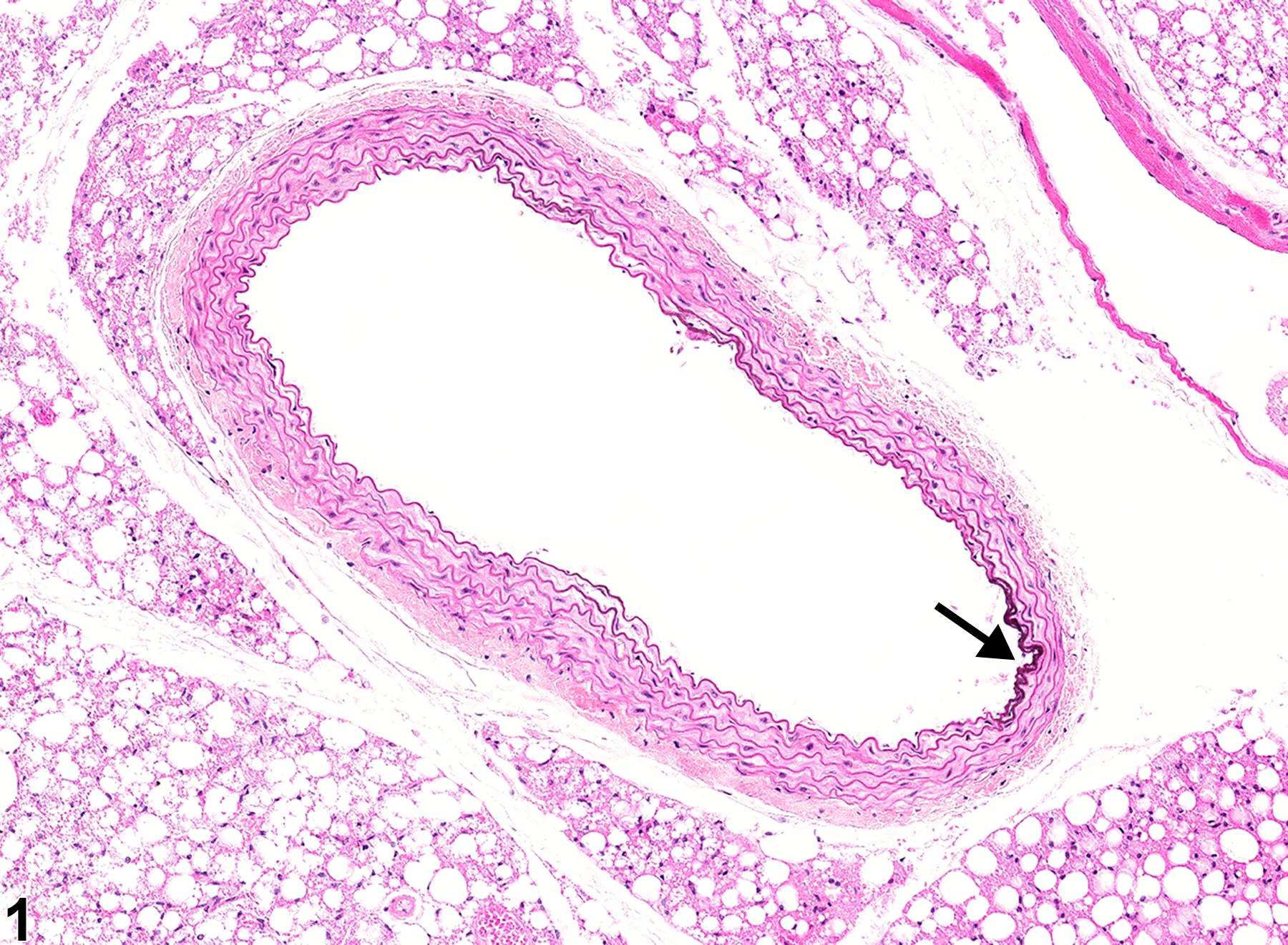 Image of mineral in the aorta from a male B6C3F1/N mouse in a chronic study