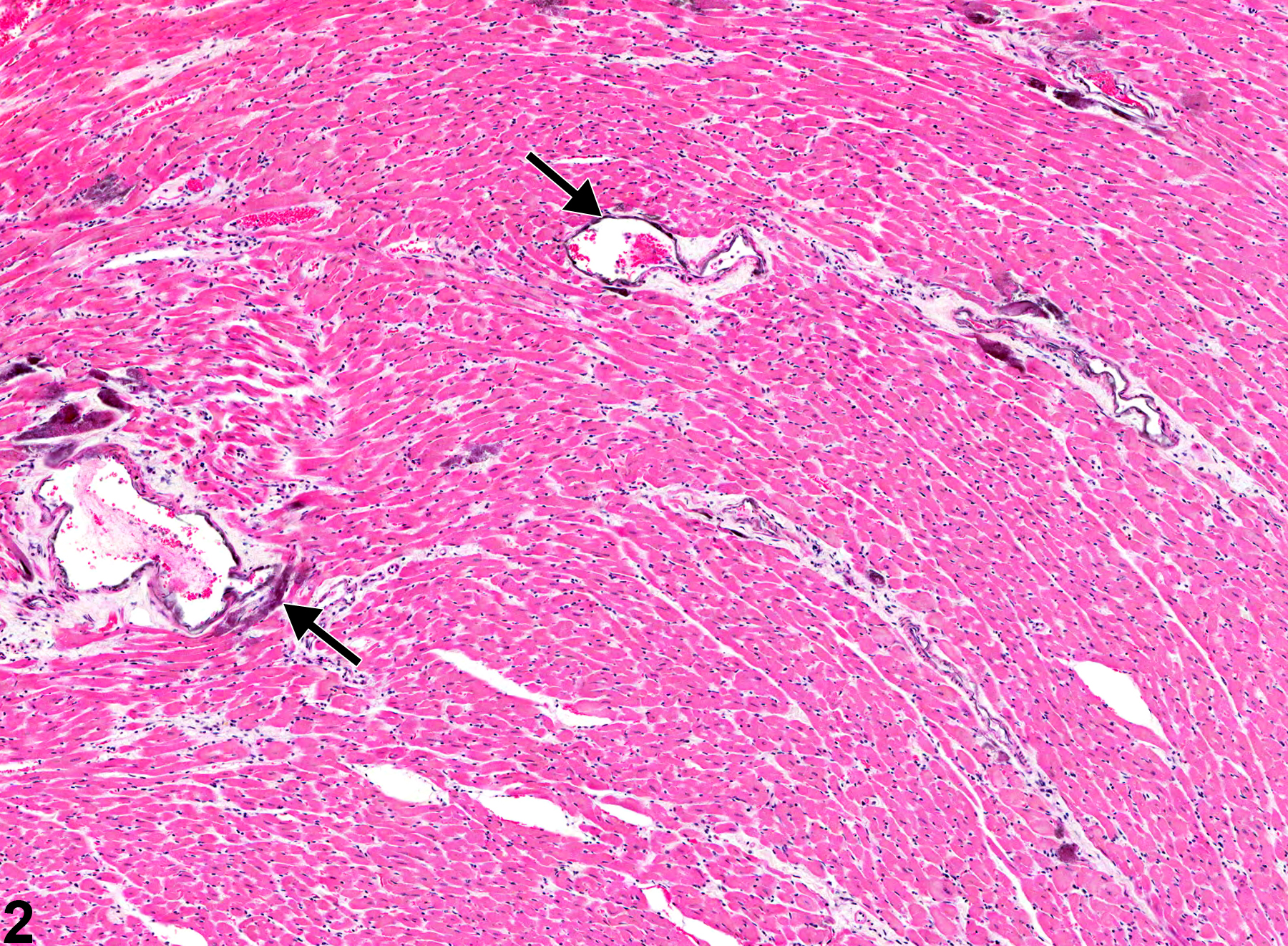 Image of mineral in the aorta from a male F344/N rat in a chronic study