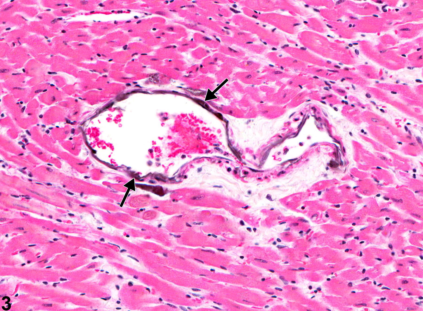 Image of mineral in the heart, artery from a male F344/N rat in a chronic study