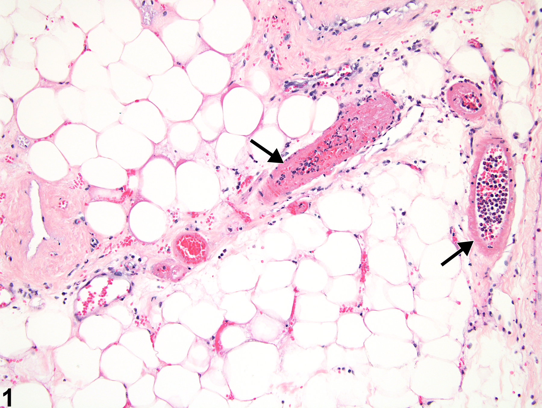Image of necrosis in the mammary gland, arteriole from a female F344/N rat in a chronic study