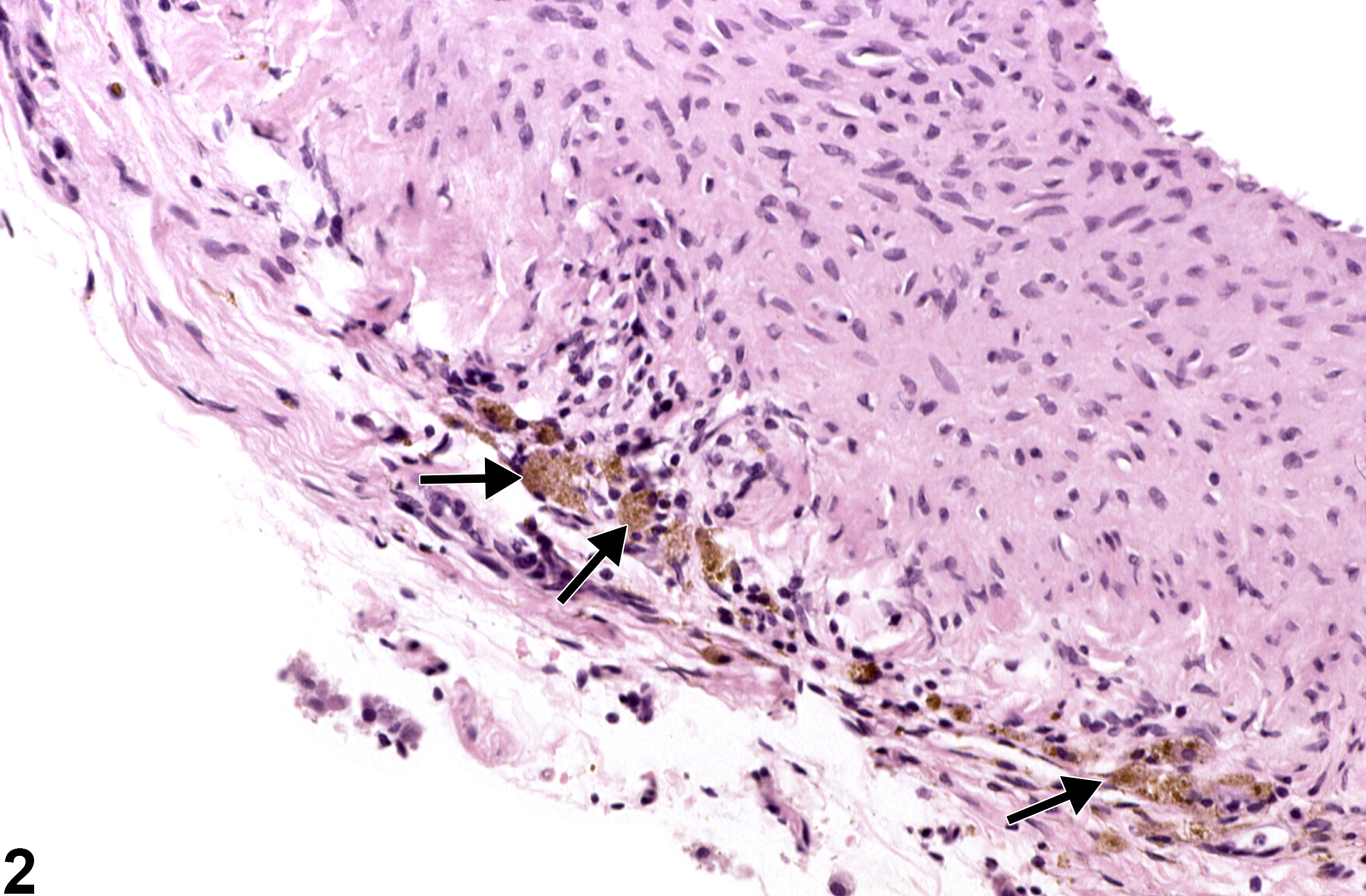 Image of pigment in the mesentery, artery from a male F344/N rat in a chronic study