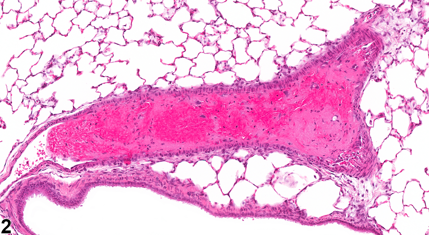 Image of thrombus in the blood vessel from a female F344/N rat in a subchronic study