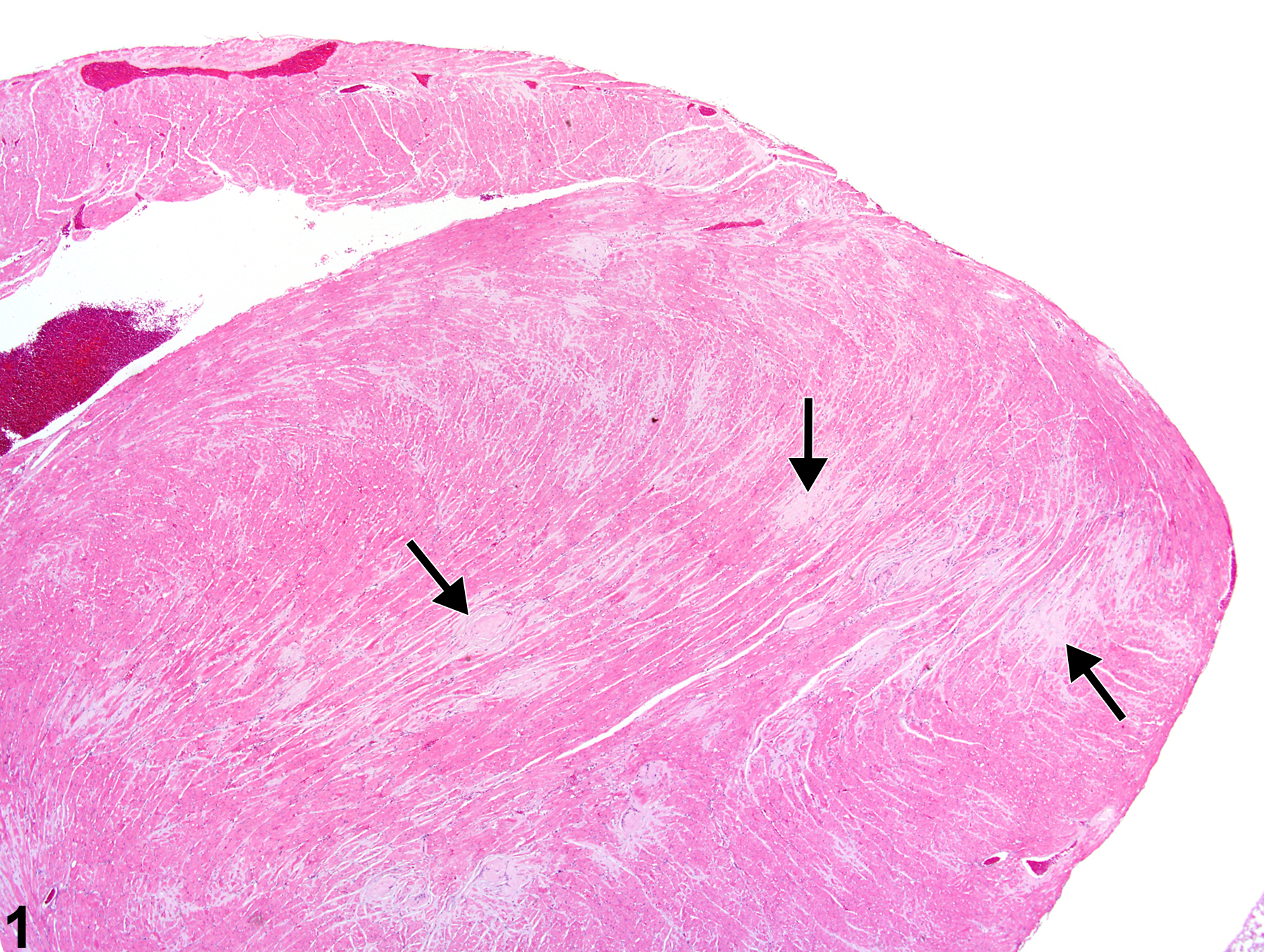 Image of amyloid in the heart from a male Swiss Webster mouse in a chronic study