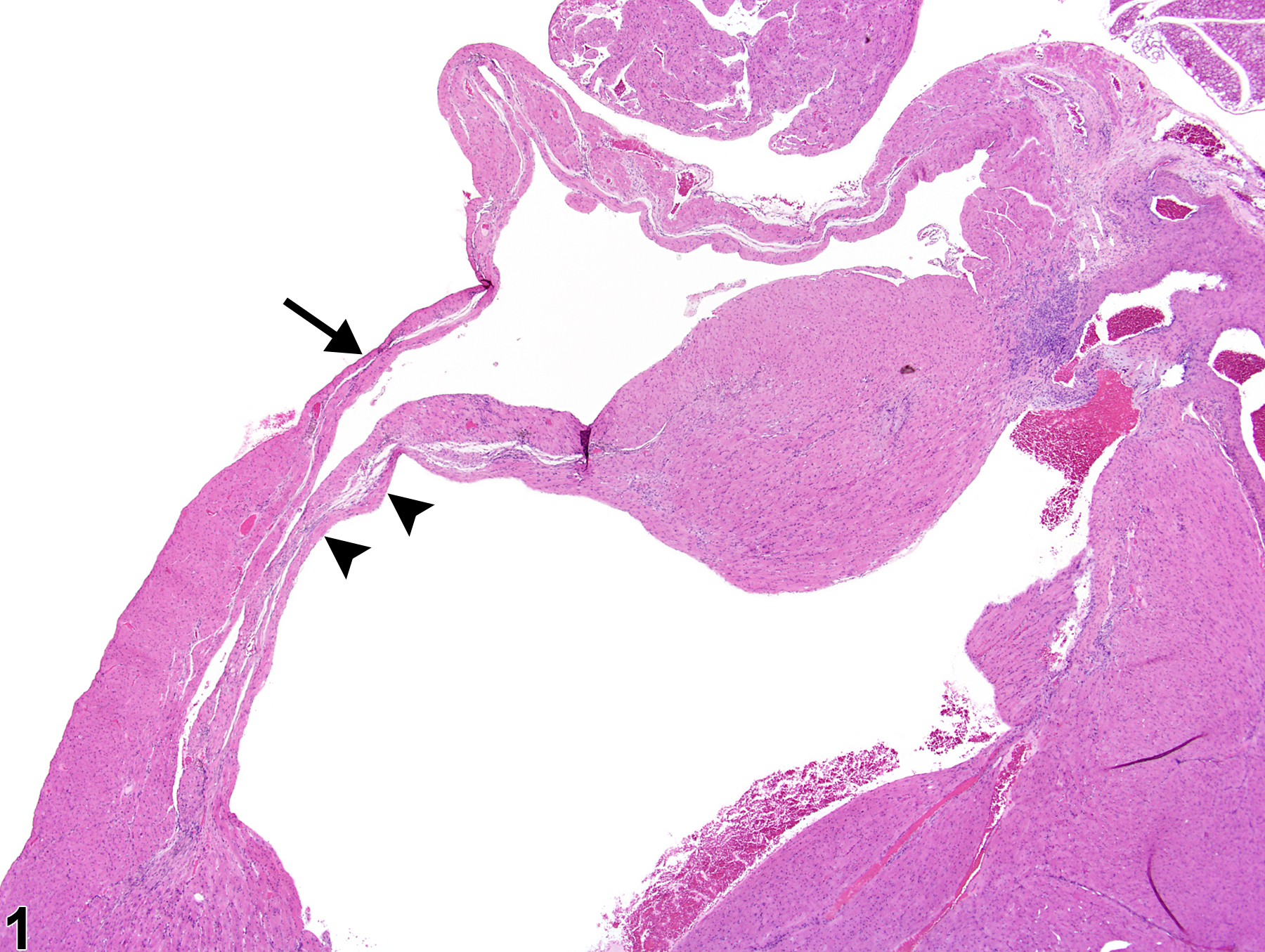 Image of atrophy in the heart from a male B6C3F1/N mouse in a chronic study