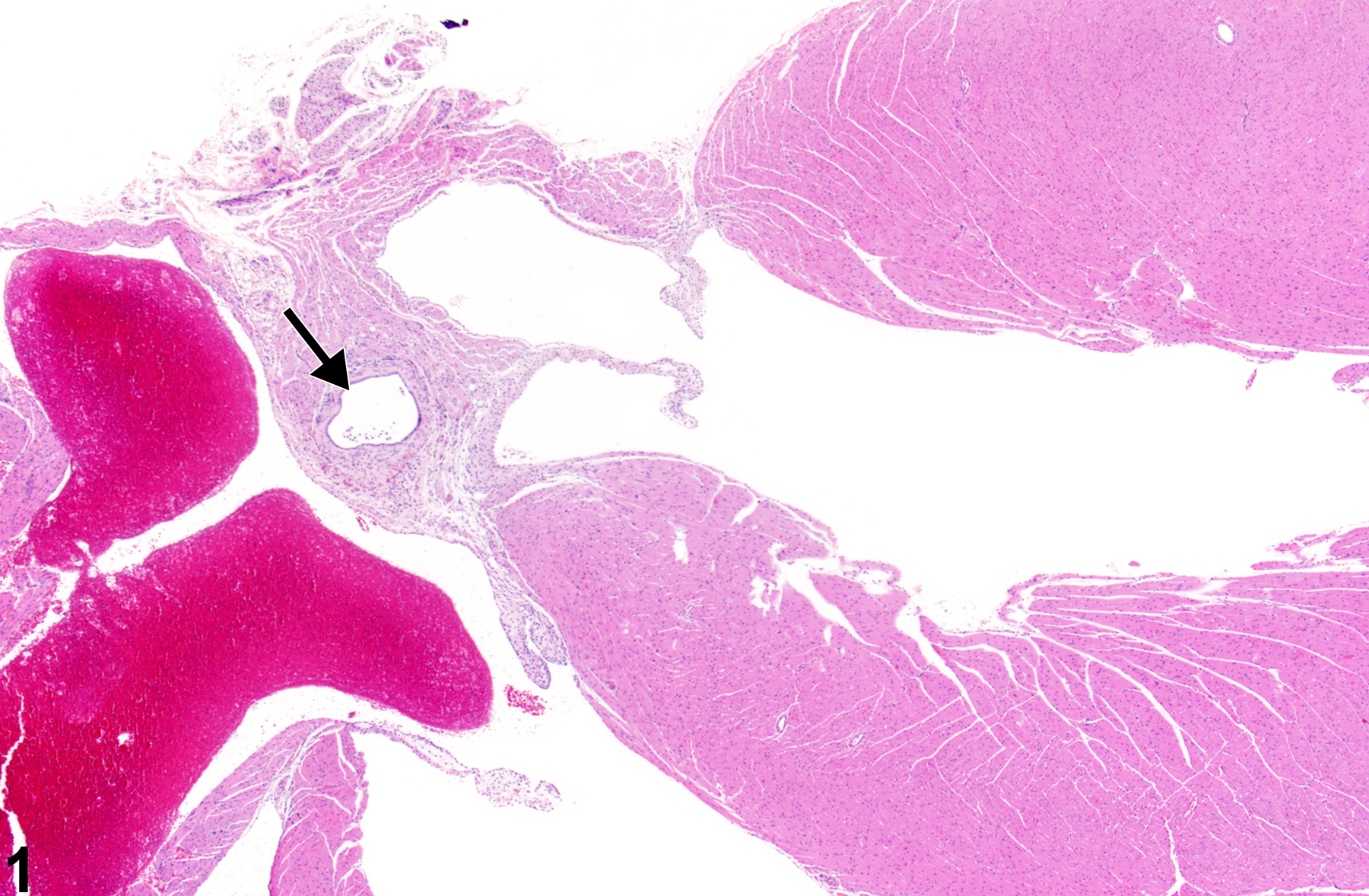 Image of cyst in the heart from a male BALB/c mouse in a subchronic study