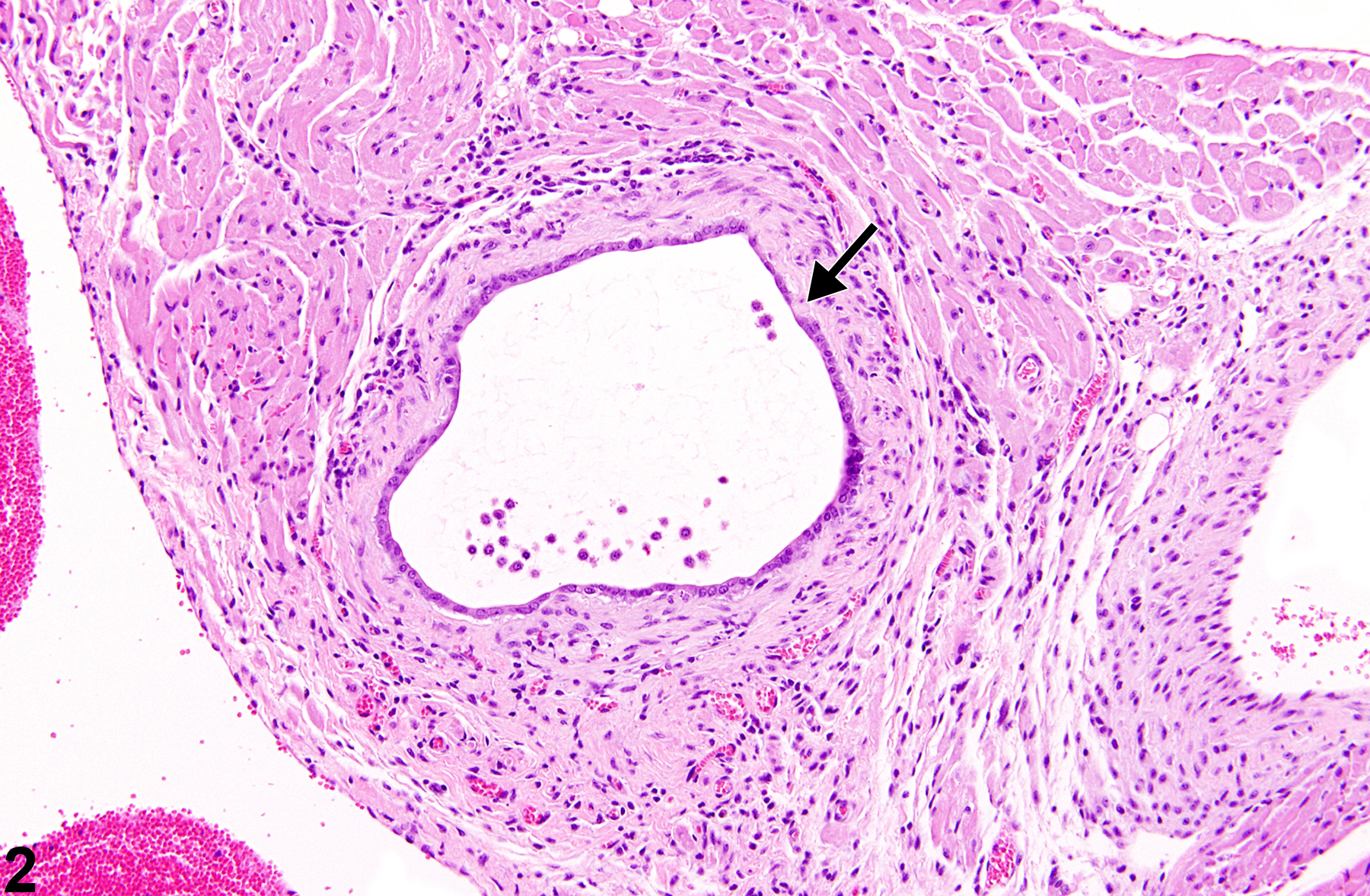 Image of cyst in the heart from a male BALB/c mouse in a subchronic study