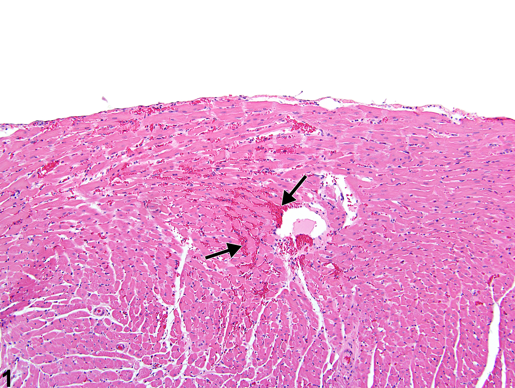 Image of hemorrhage in the heart from a male F344/N rat in a acute study