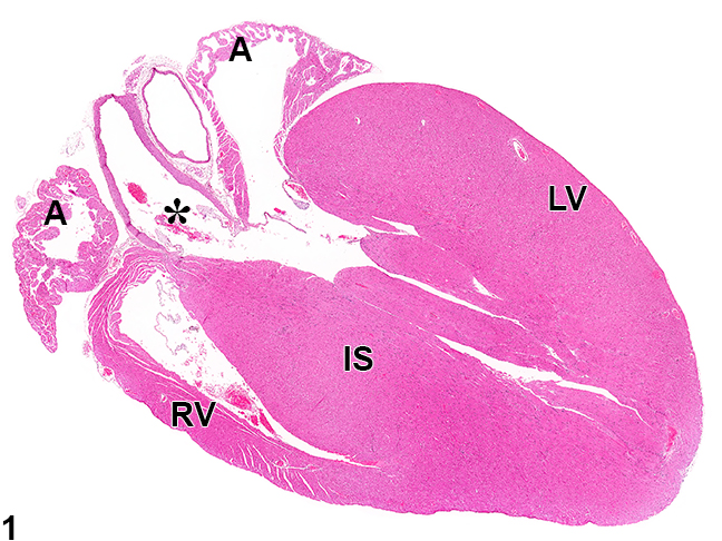 Image of normal heart from a male B6C3F1/N mouse in a chronic study
