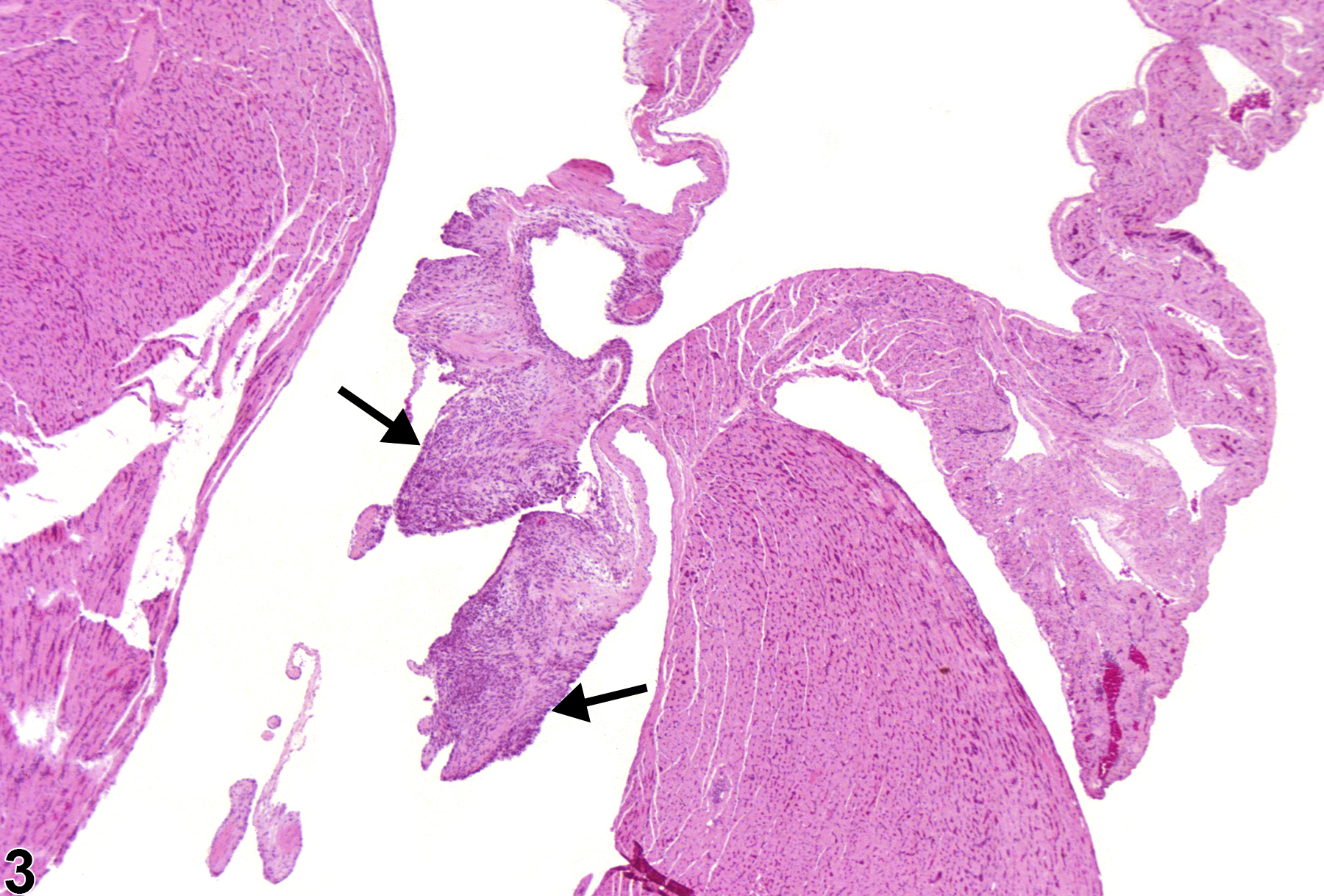 Image of inflammation in the heart from a female F344/N rat in a chronic study