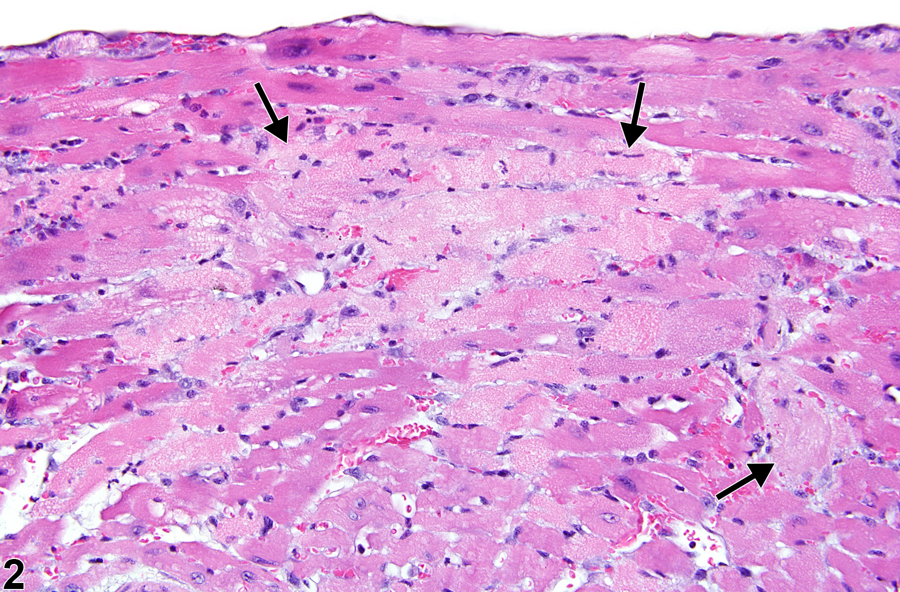 Image of necrosis in the heart, myocardium from a male P16(ink4a)/(+/-)(C57BL/6)  mouse in a acute study