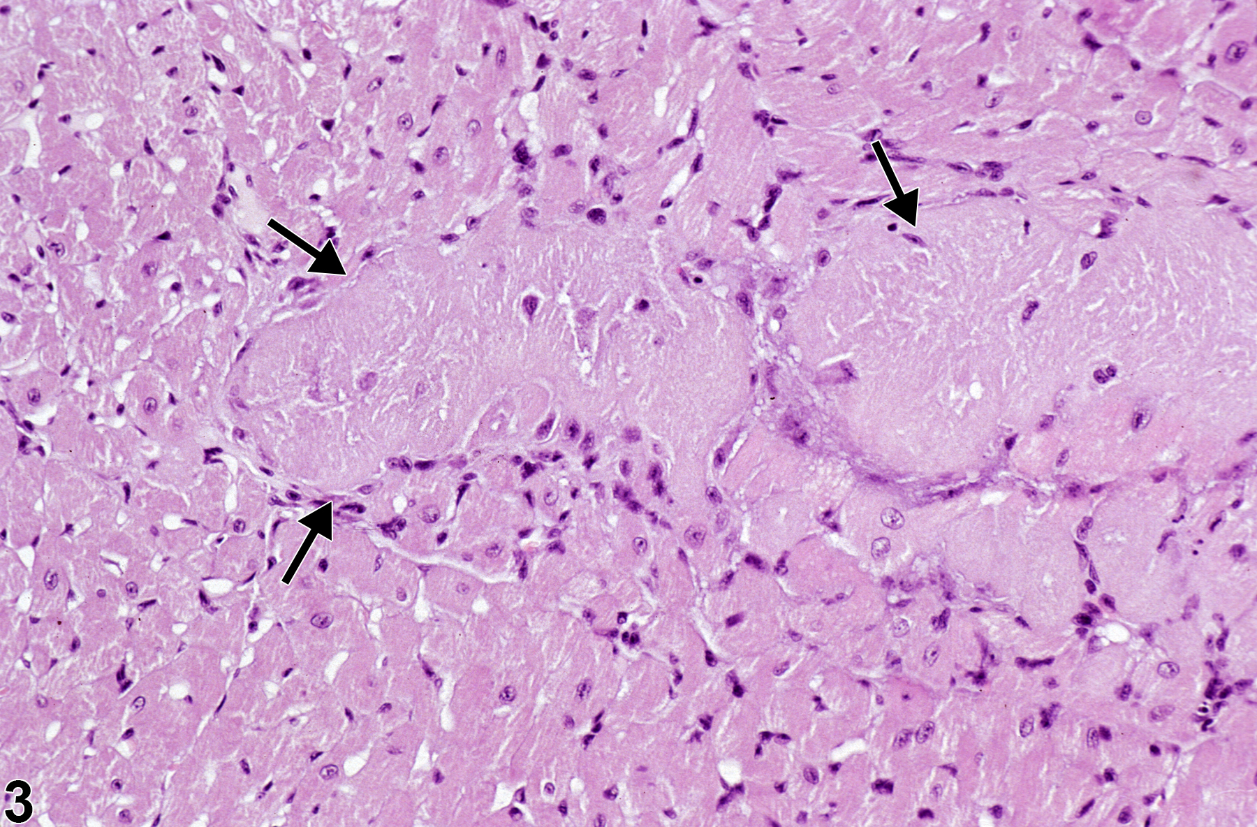 Image of necrosis in the heart, myocardium from a male P16(ink4a)/(+/-)(C57BL/6)  mouse in a acute study