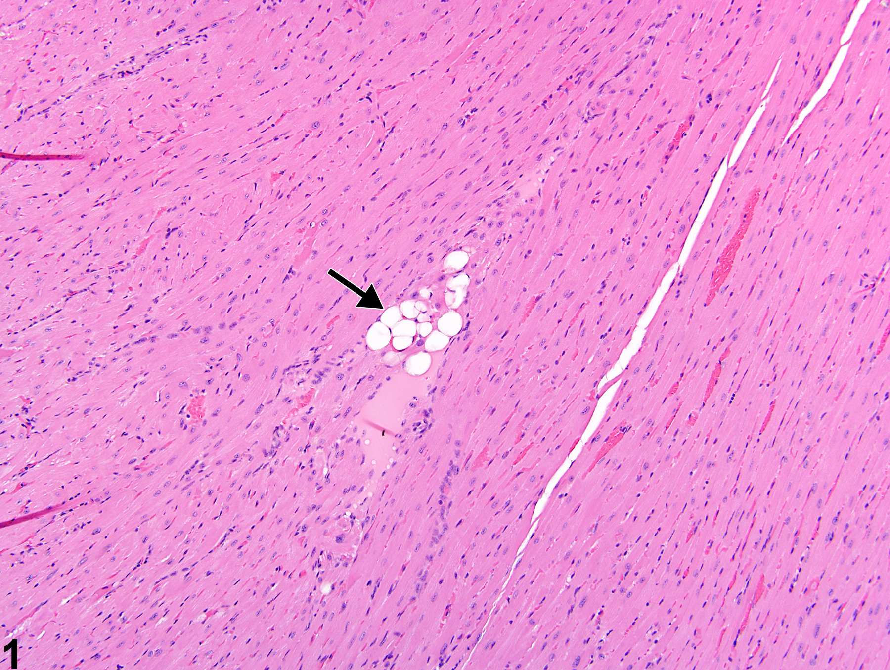 Image of vacuolization, cytoplasmic in the heart, myocardium from a female B6C3F1/N mouse in a subchronic study
