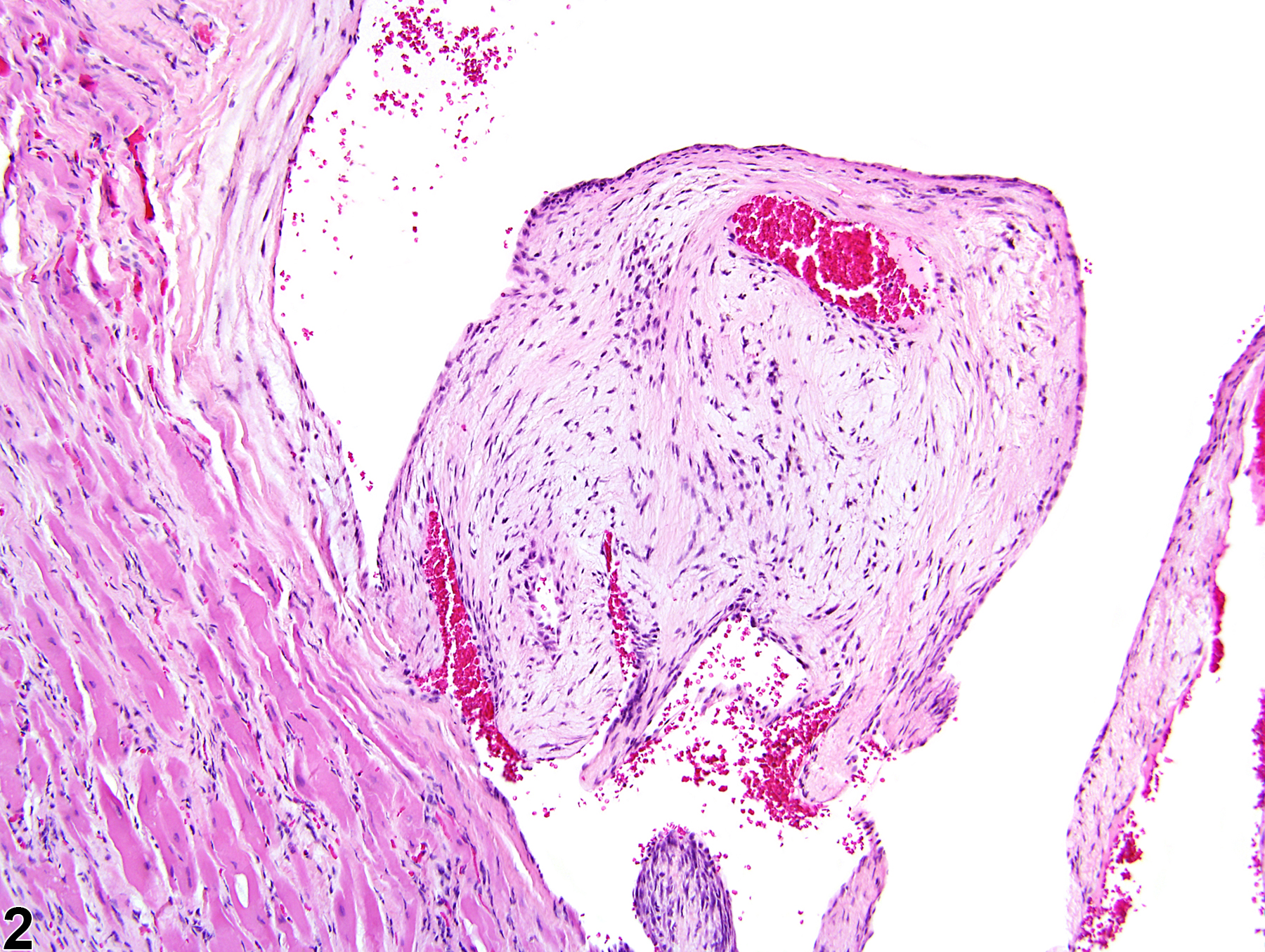 Image of degeneration, myxomatous in the heart, valve from a female F344/N rat in a chronic study