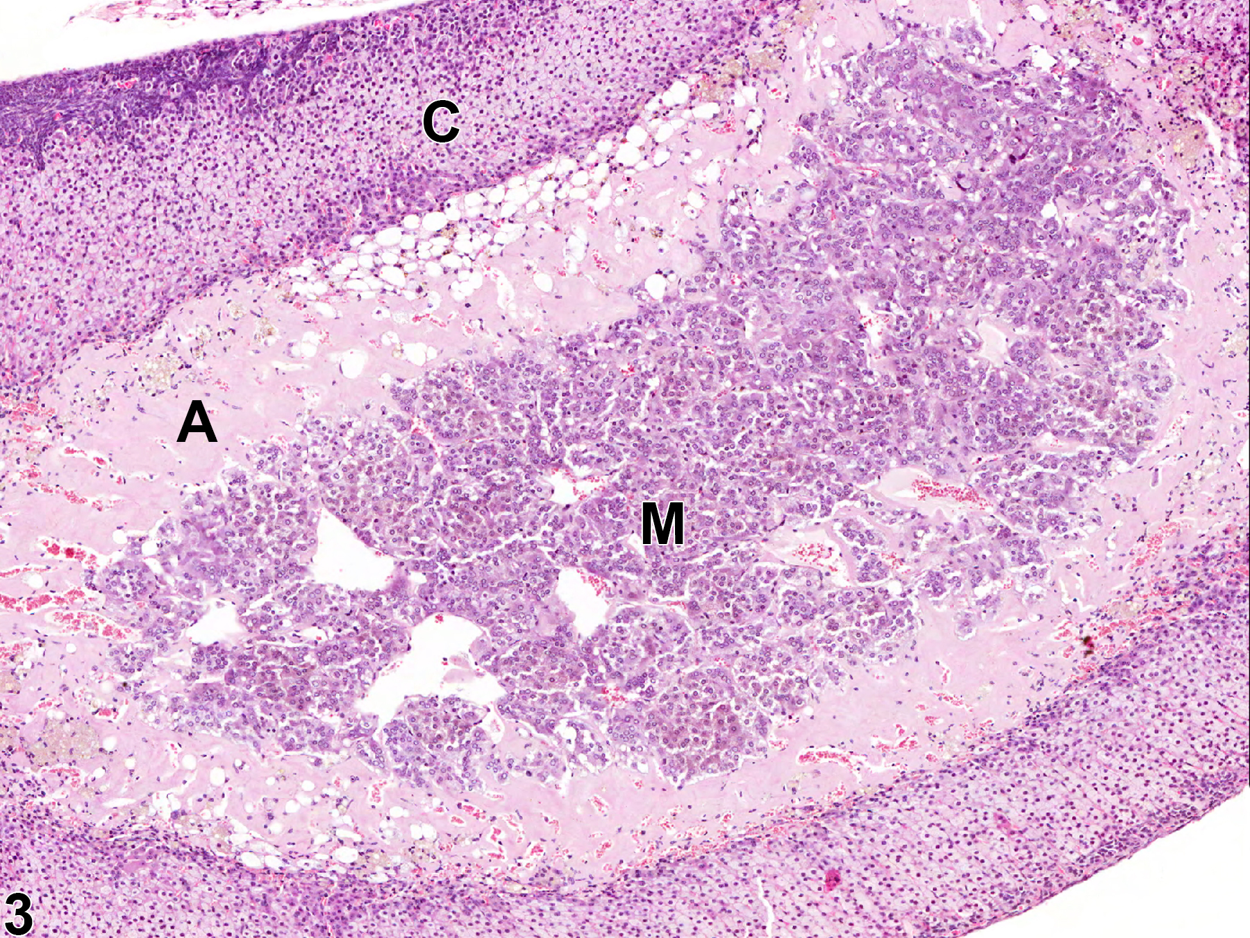 Image of amyloid in the adrenal gland from a male Swiss Webster mouse in a chronic study