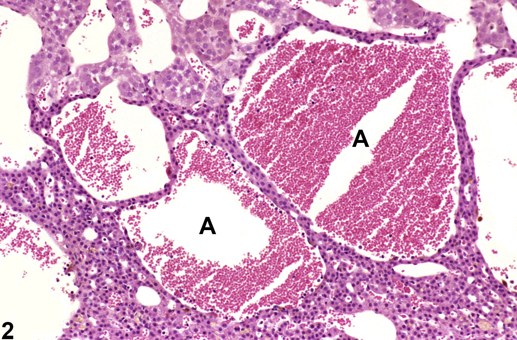 Image of angiectasis in the adrenal gland from a male F344/N rat in a chronic study